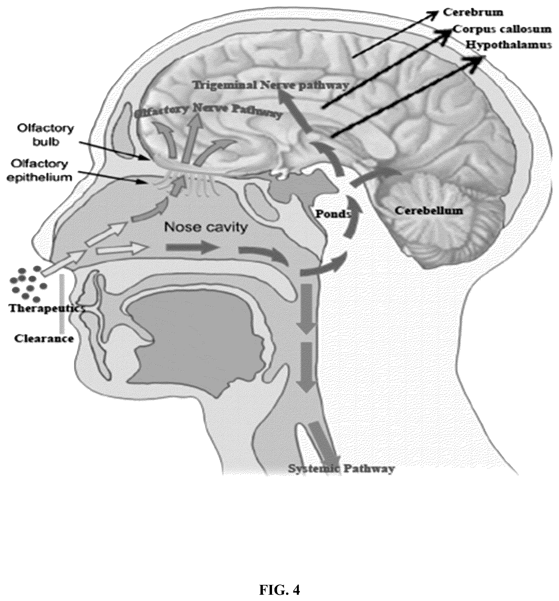 Patent US12090130 Figure 4 – Methods of treating brain disorders