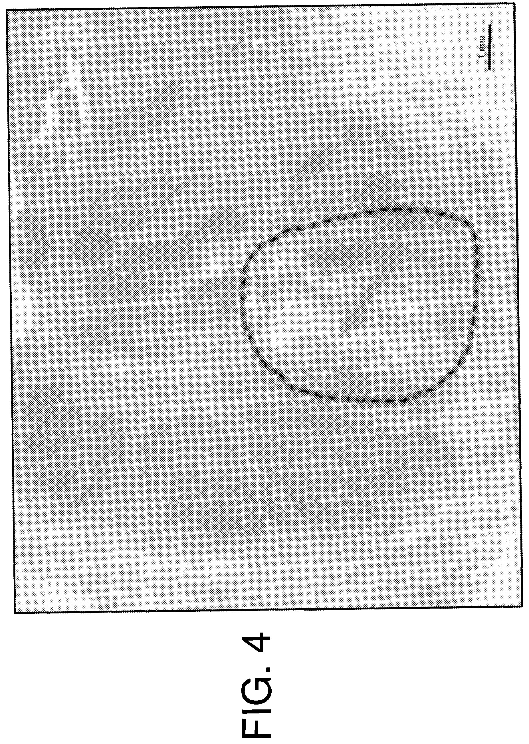 Patent US12090136 Figure 6 – Apparatus for treating Benign Prostatic Hyperplasia