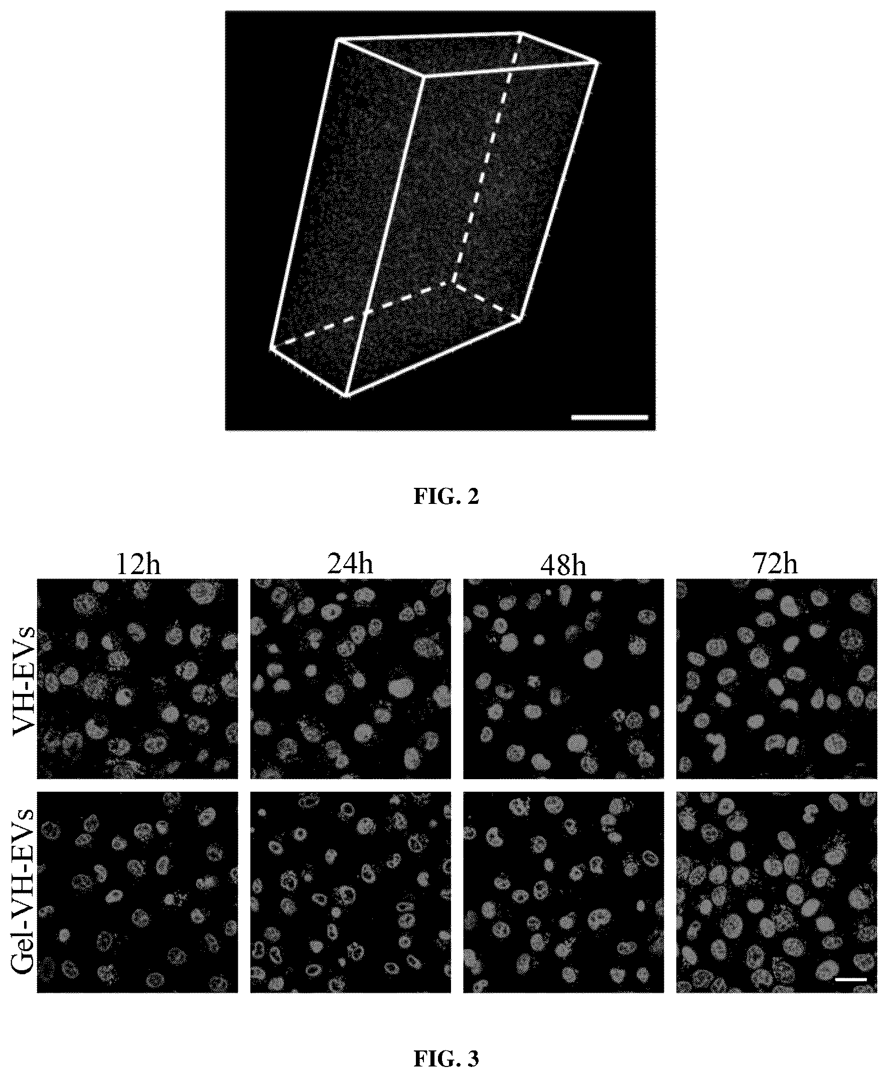 Patent US12090144 Figure 2 – Photocurable hydrogel loaded with VH298-modified exosome and method of preparation and use thereof