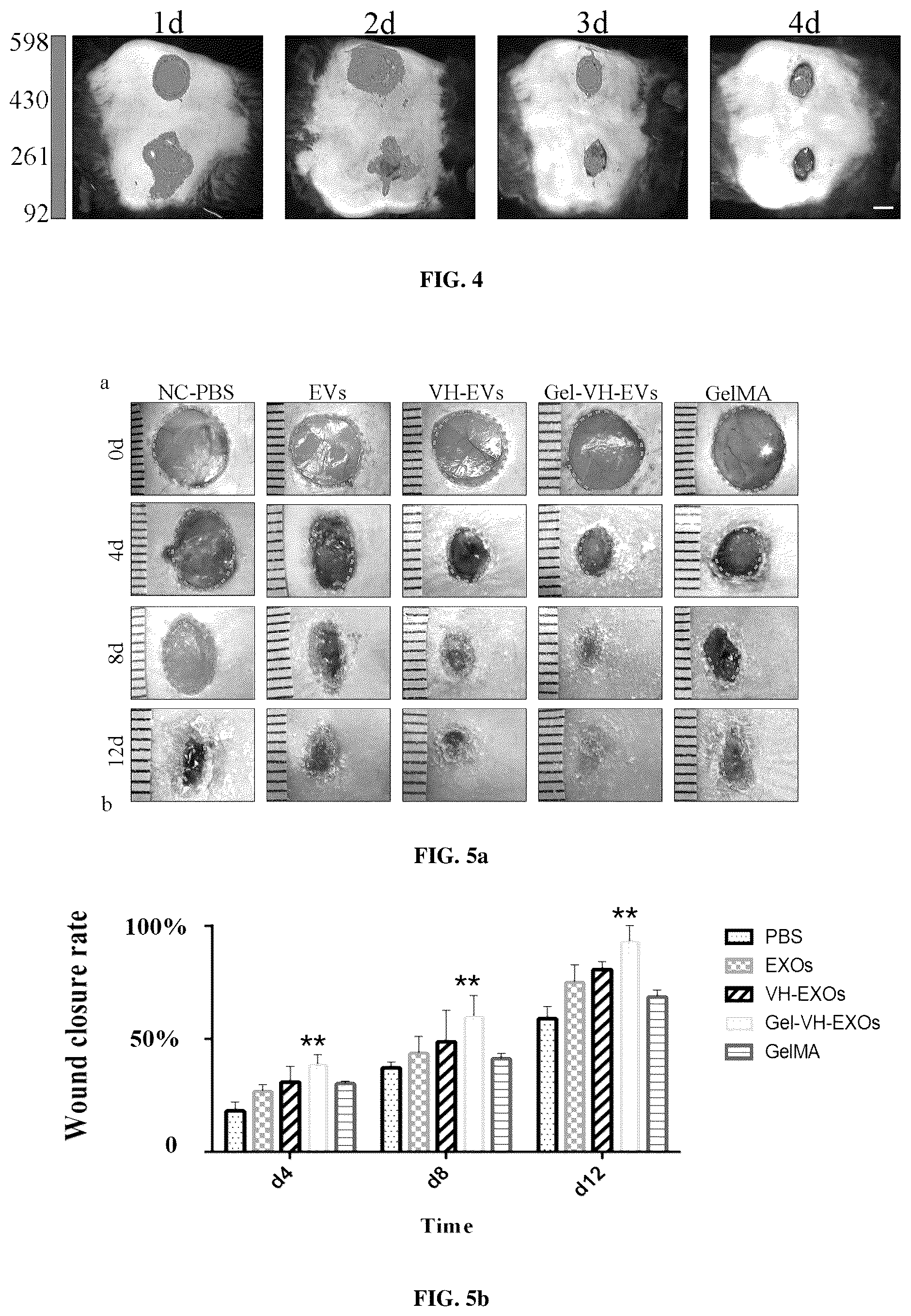 Patent US12090144 Figure 3 – Photocurable hydrogel loaded with VH298-modified exosome and method of preparation and use thereof