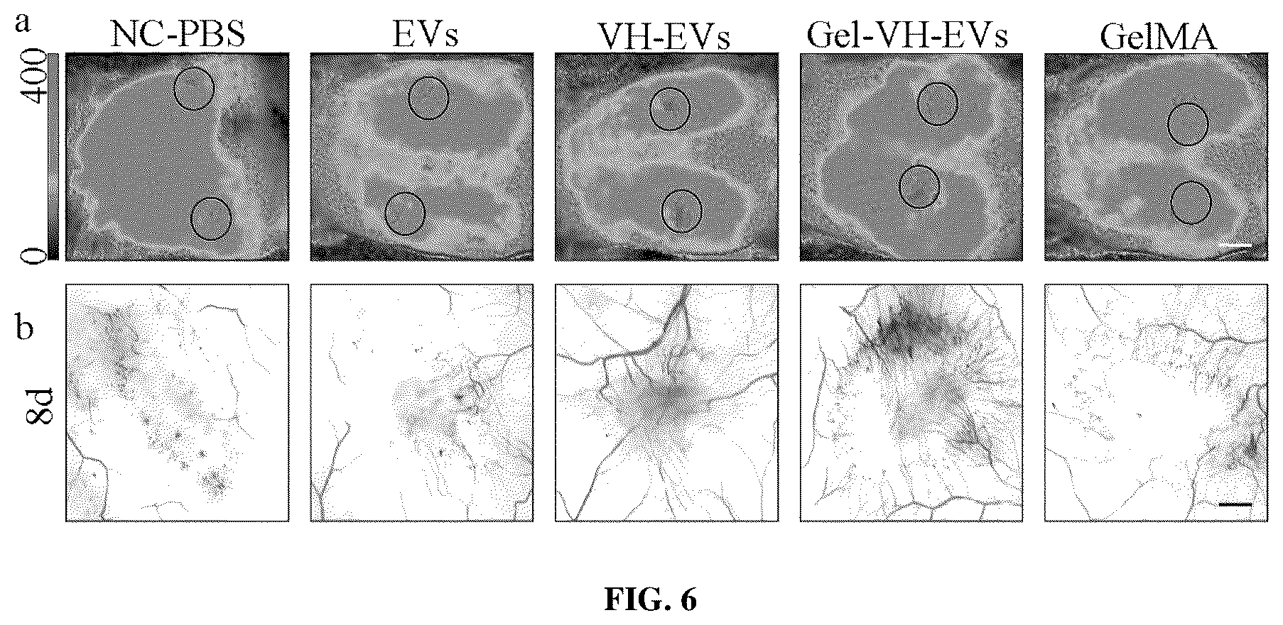 Patent US12090144 Figure 4 – Photocurable hydrogel loaded with VH298-modified exosome and method of preparation and use thereof