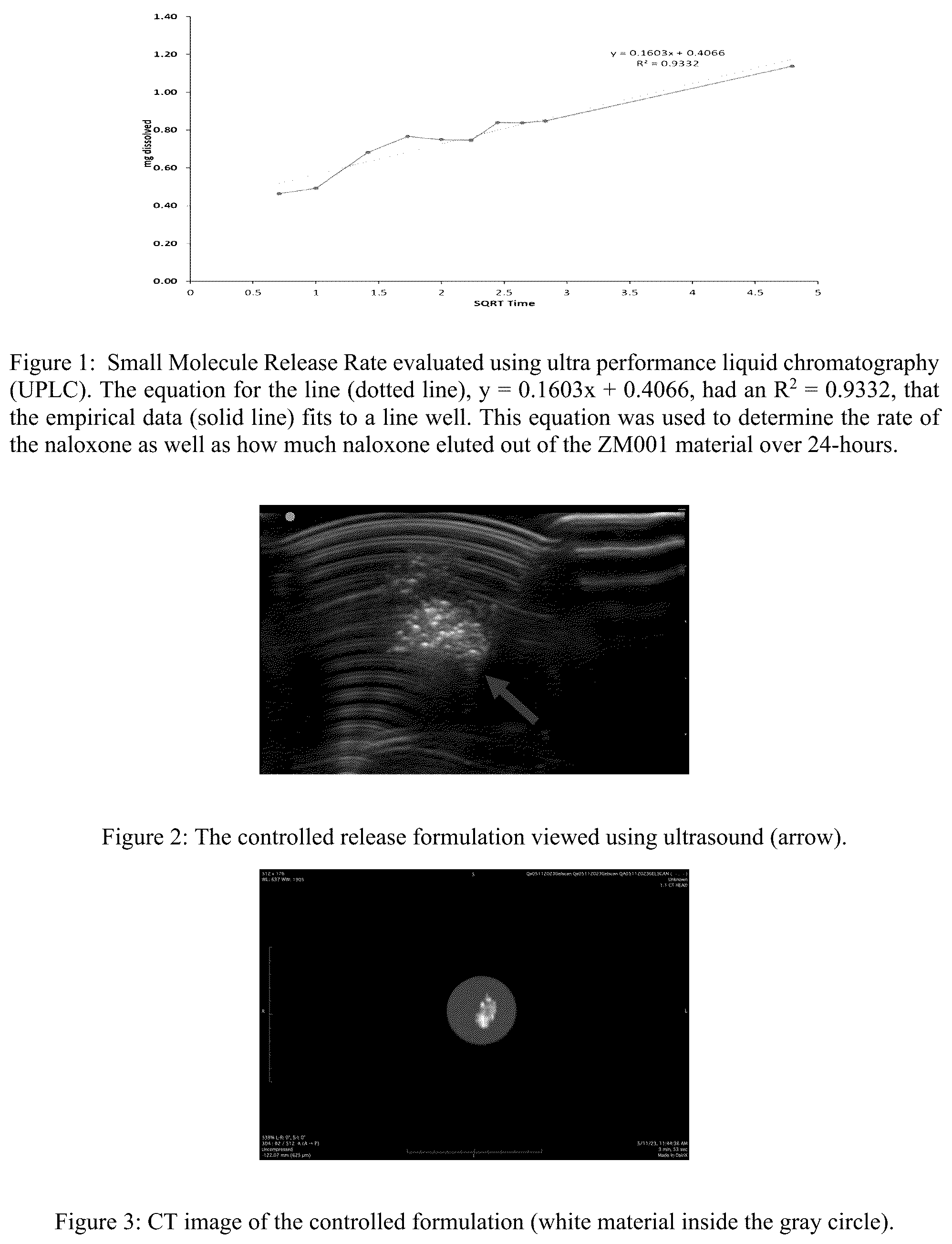 Patent US12090152 Figure 1 – Controlled release formulation and minimally invasive method of administration