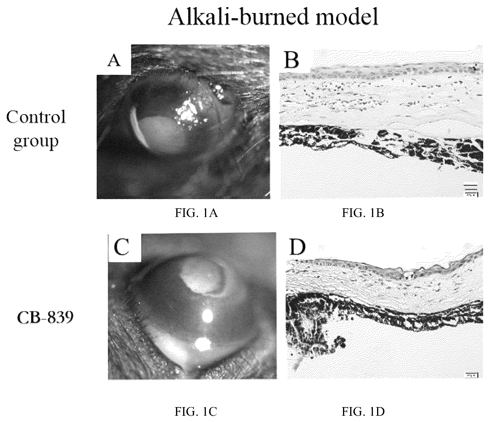 Patent US12090156 — Application of CB-839 in preparation of drug for inhibiting corneal neovascularization (CNV) — Figure 1