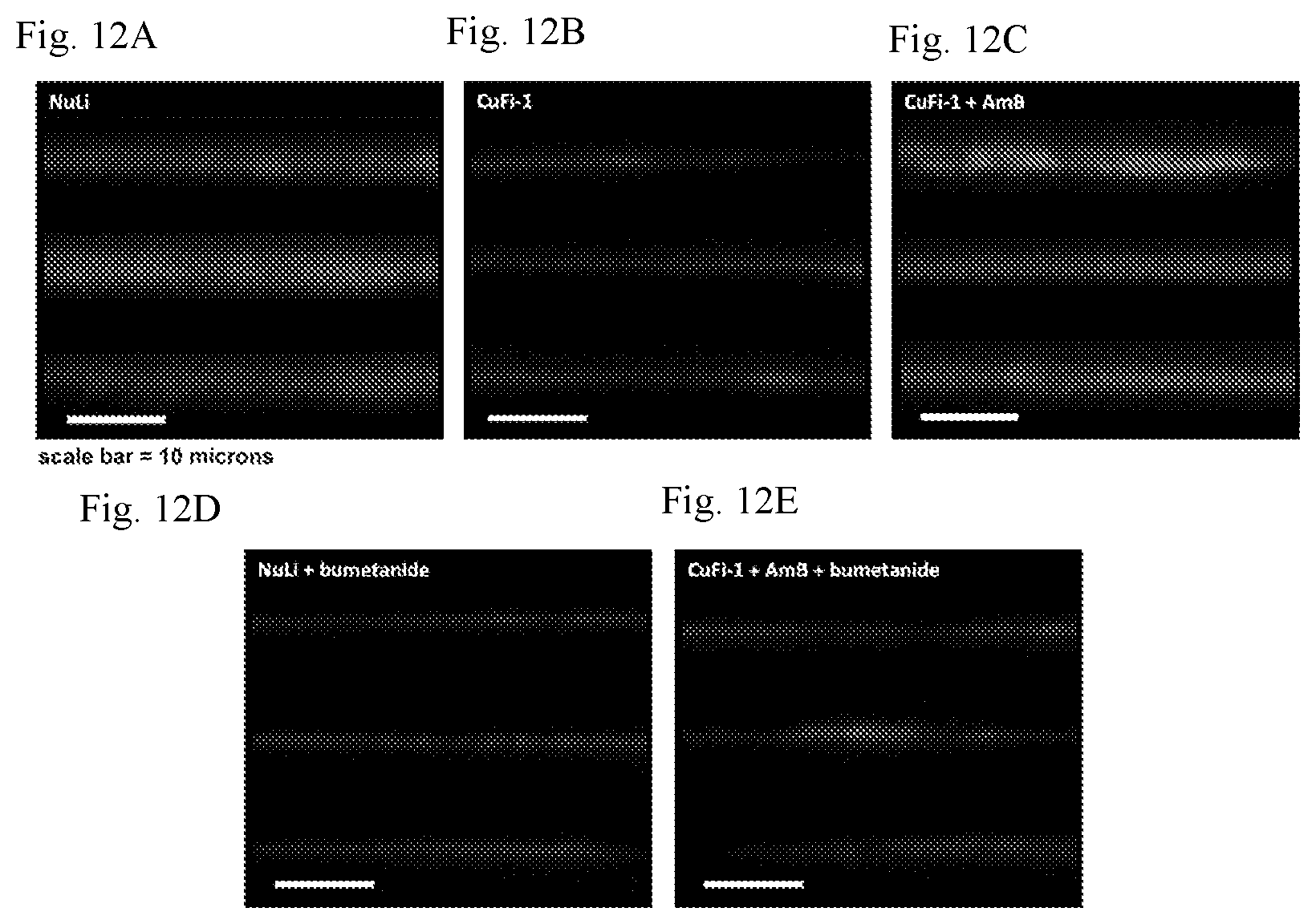 Patent US12090164 Figure 13 – Genotype-agnostic rescue of cystic fibrosis with small molecule bicarbonate channels
