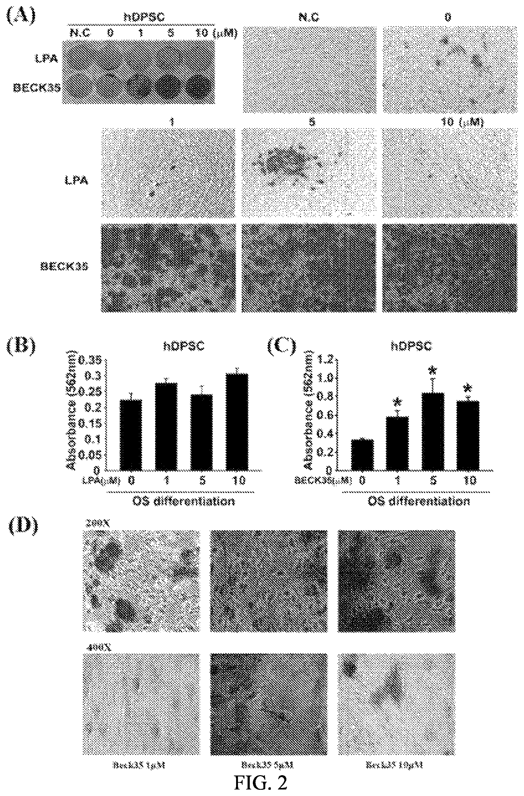 Patent US12090166 Figure 2 – Pharmaceutical composition for preventing or treating dentin-dental pulp disease or periodontal disease, containing LPAR2 inhibitor