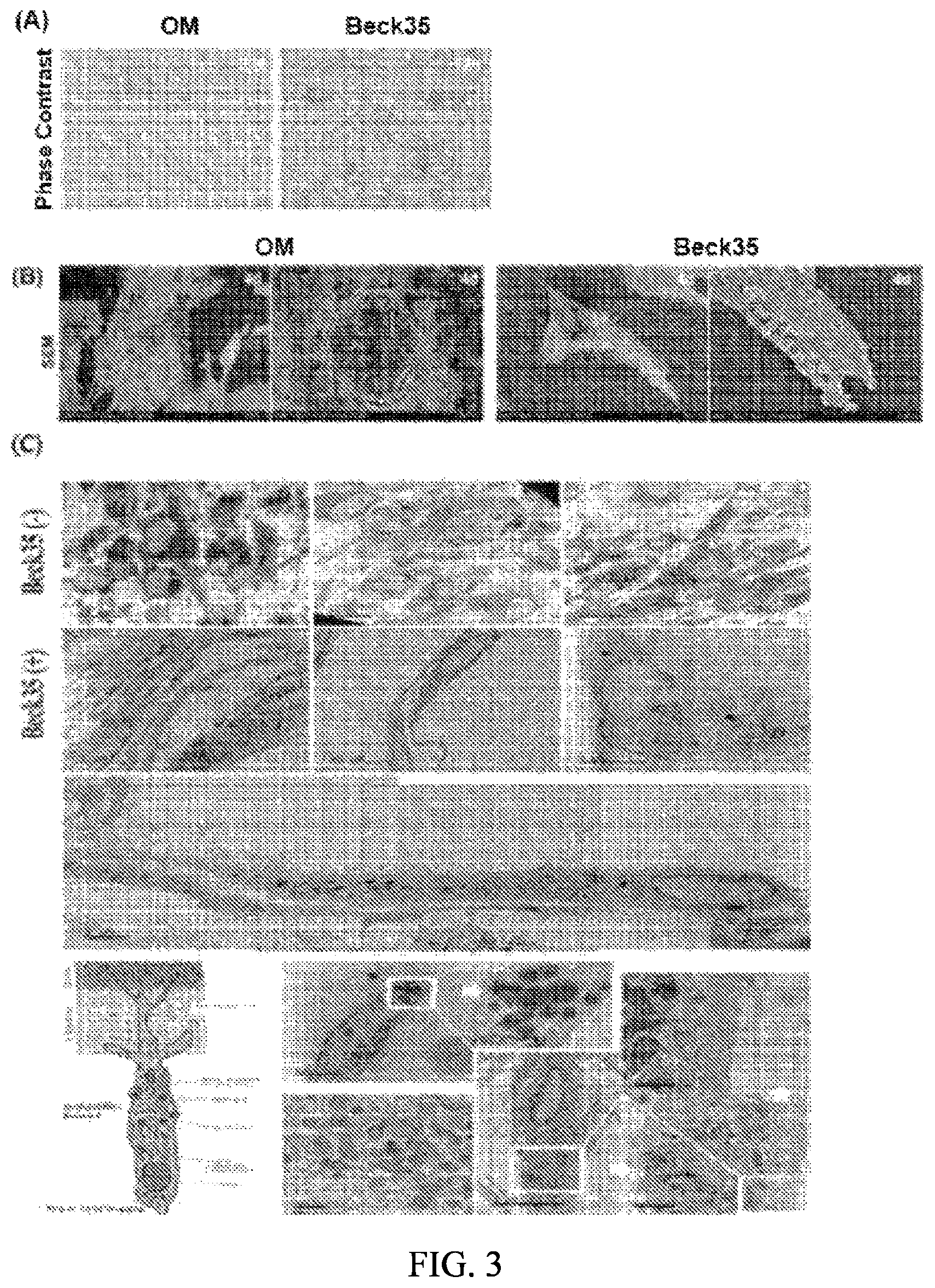 Patent US12090166 Figure 3 – Pharmaceutical composition for preventing or treating dentin-dental pulp disease or periodontal disease, containing LPAR2 inhibitor