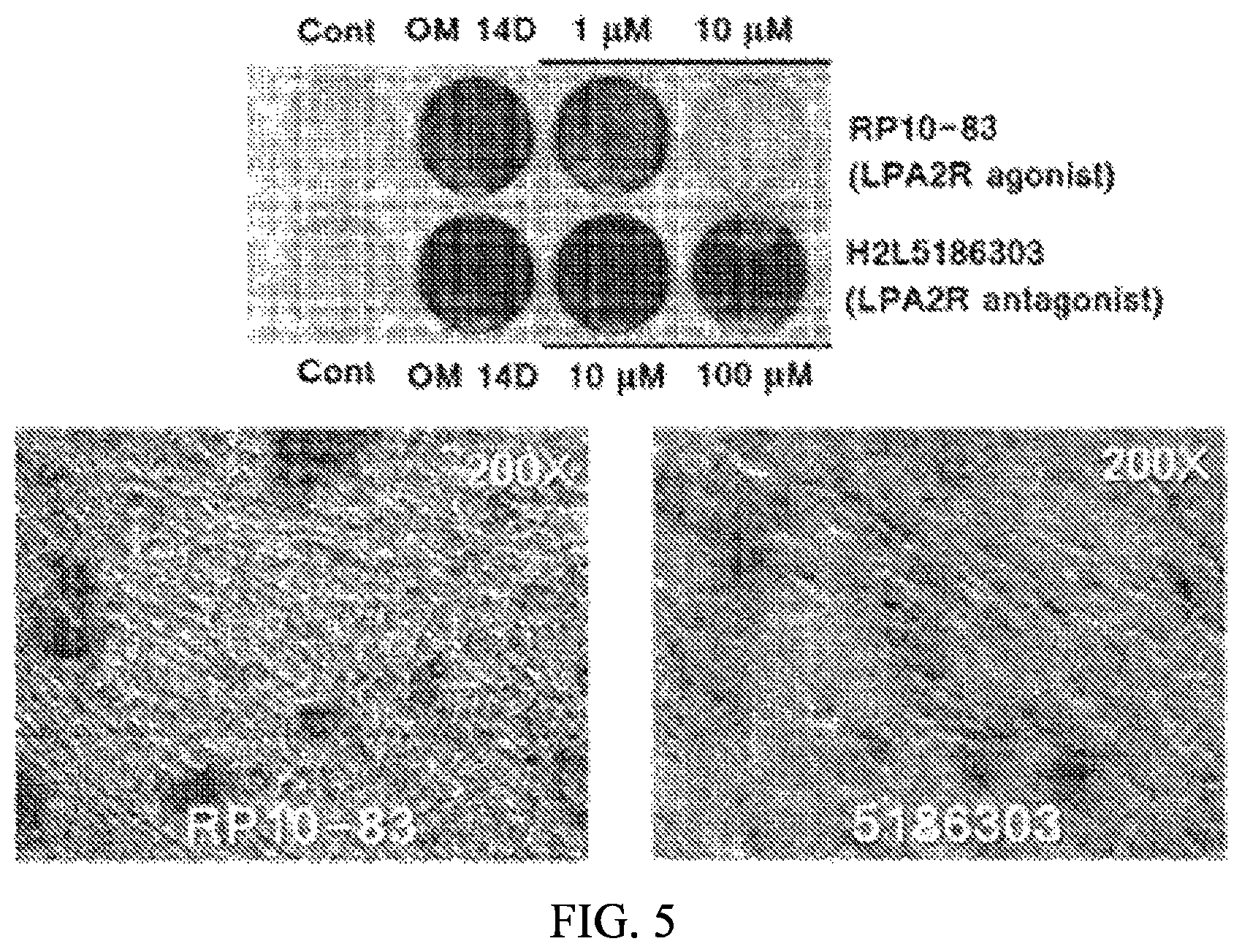 Patent US12090166 Figure 5 – Pharmaceutical composition for preventing or treating dentin-dental pulp disease or periodontal disease, containing LPAR2 inhibitor