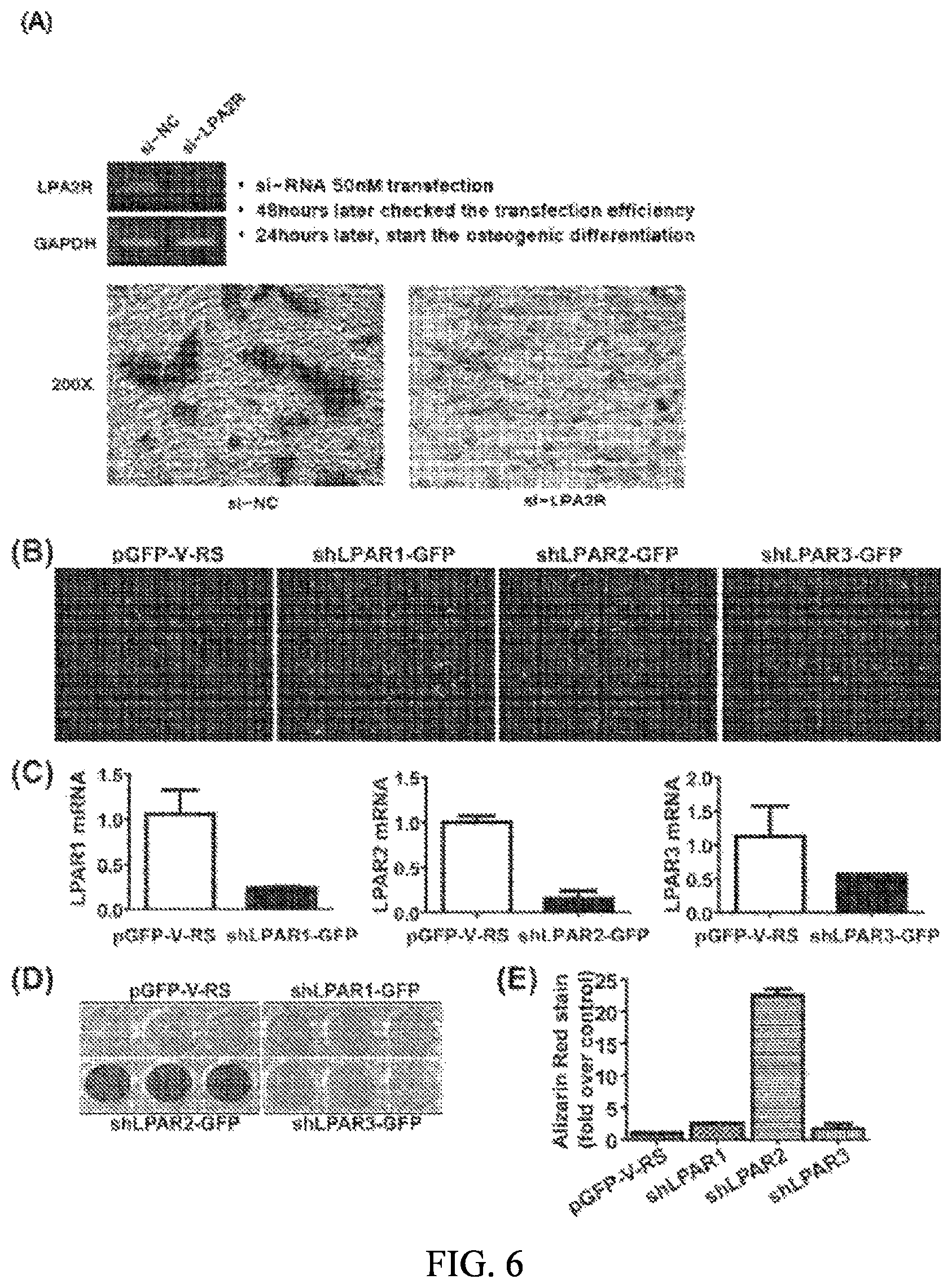 Patent US12090166 Figure 6 – Pharmaceutical composition for preventing or treating dentin-dental pulp disease or periodontal disease, containing LPAR2 inhibitor
