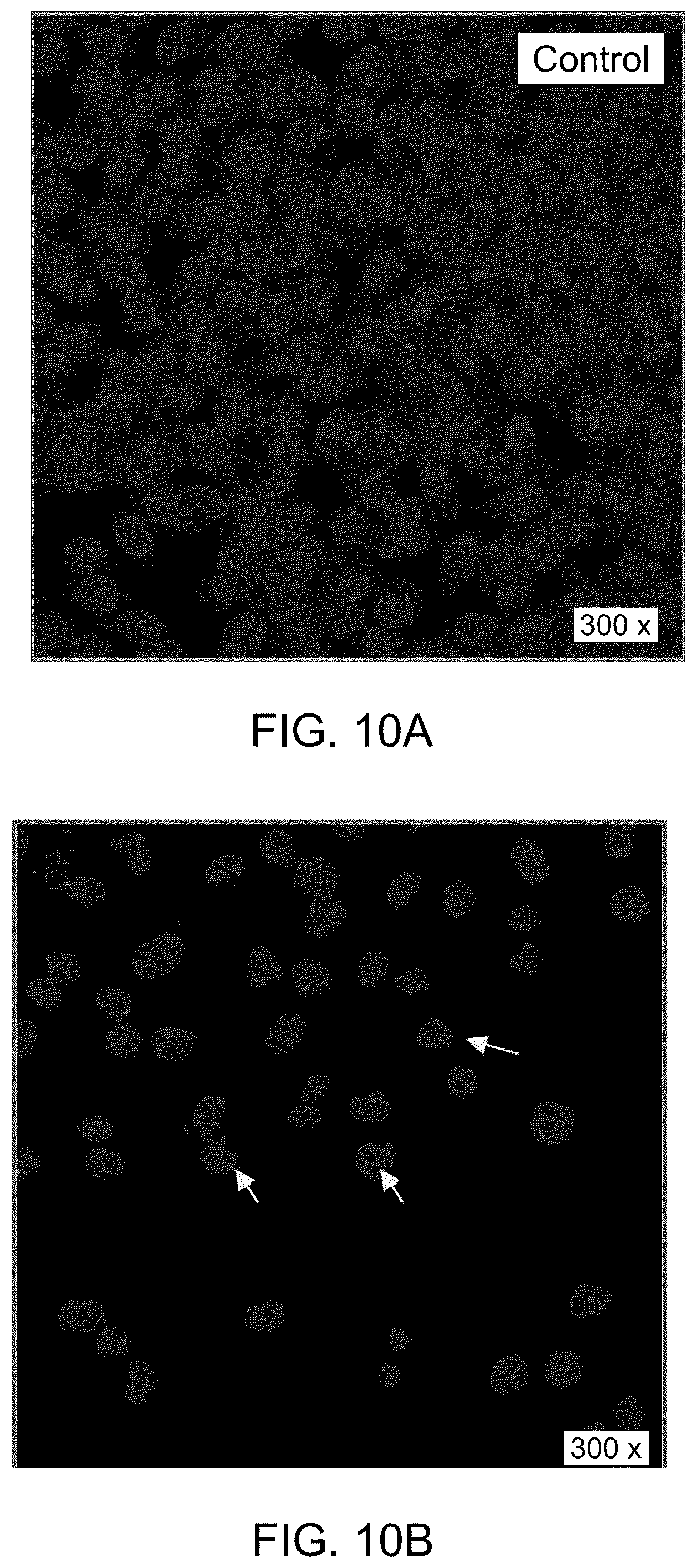 Patent US12090169 Figure 14 – Method for decreasing colorectal cancer cells