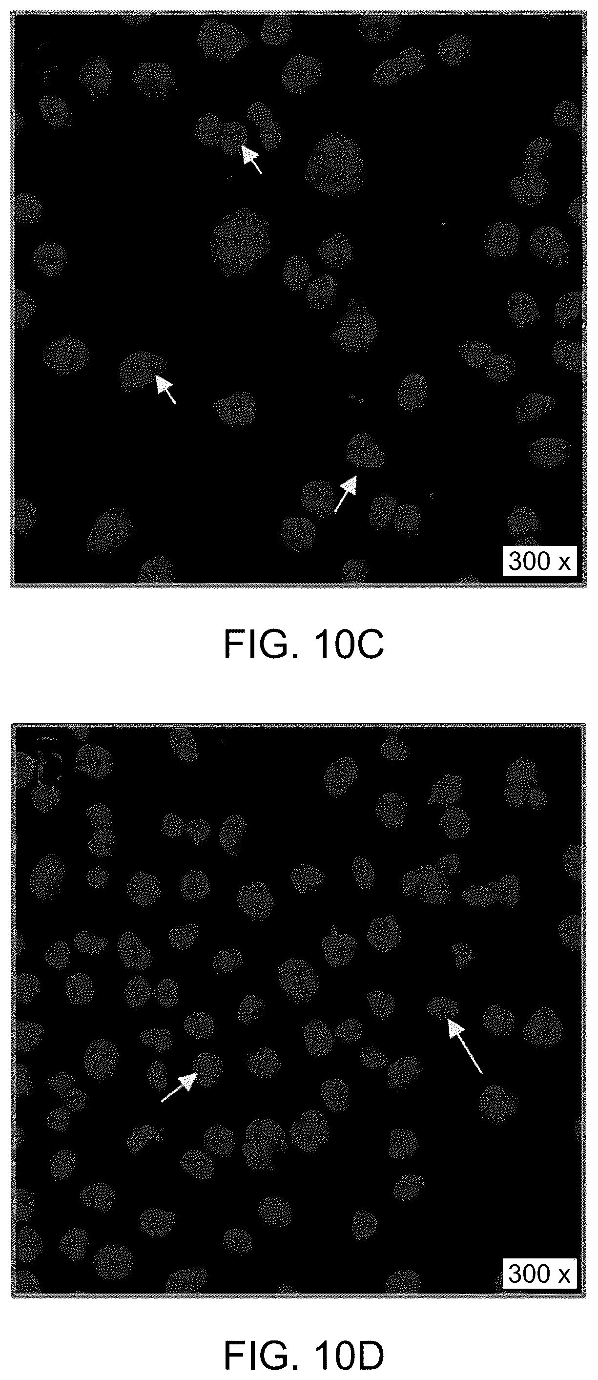 Patent US12090169 Figure 15 – Method for decreasing colorectal cancer cells