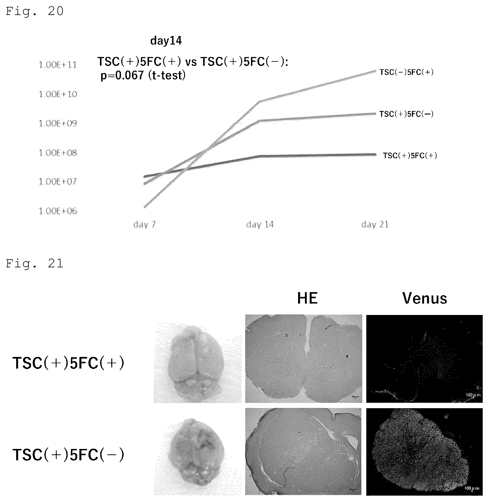 Patent US12090172 Figure 11 – Suicide gene therapeutic agent for brain tumors using pluripotent stem cell