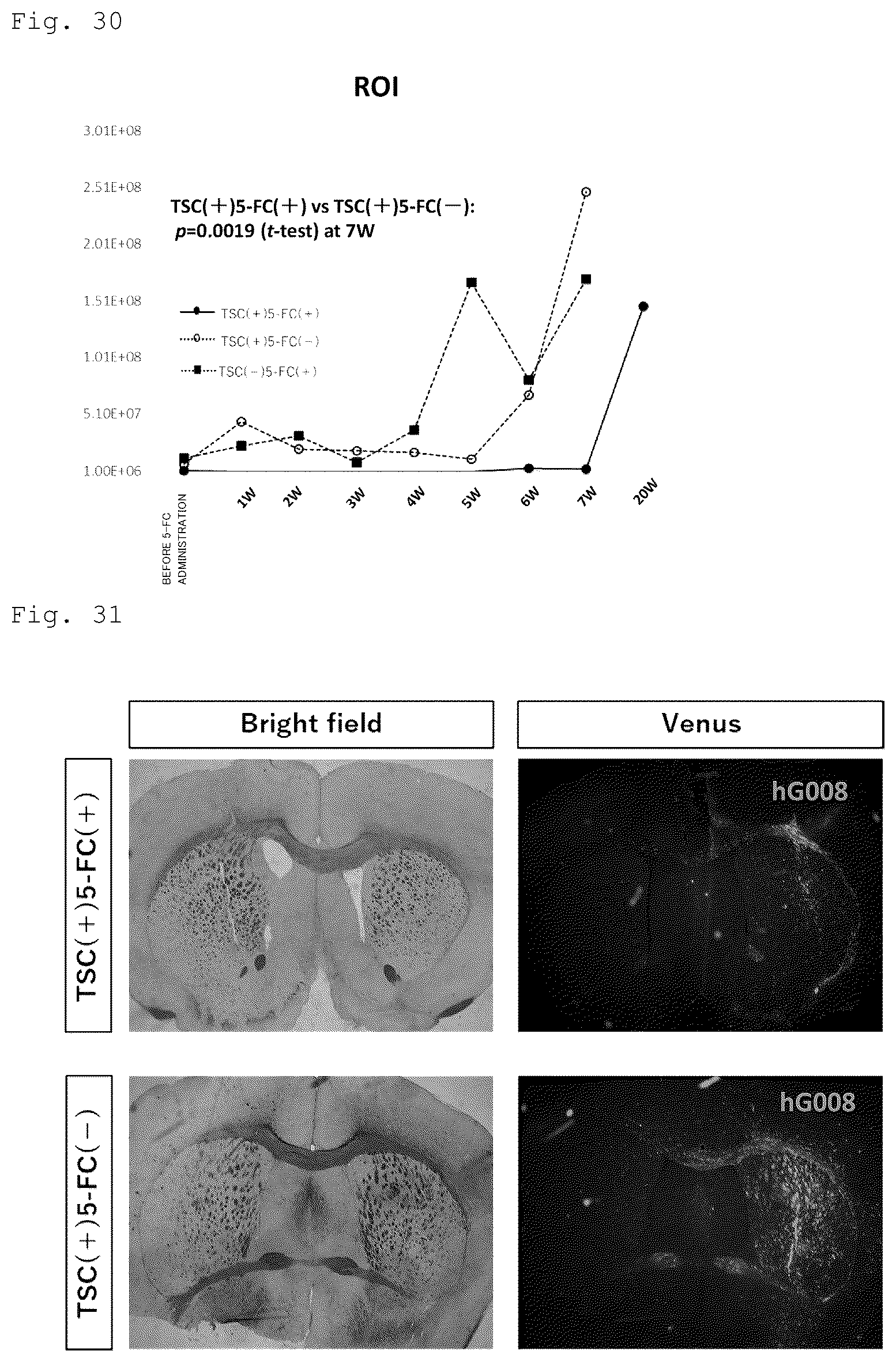Patent US12090172 Figure 16 – Suicide gene therapeutic agent for brain tumors using pluripotent stem cell