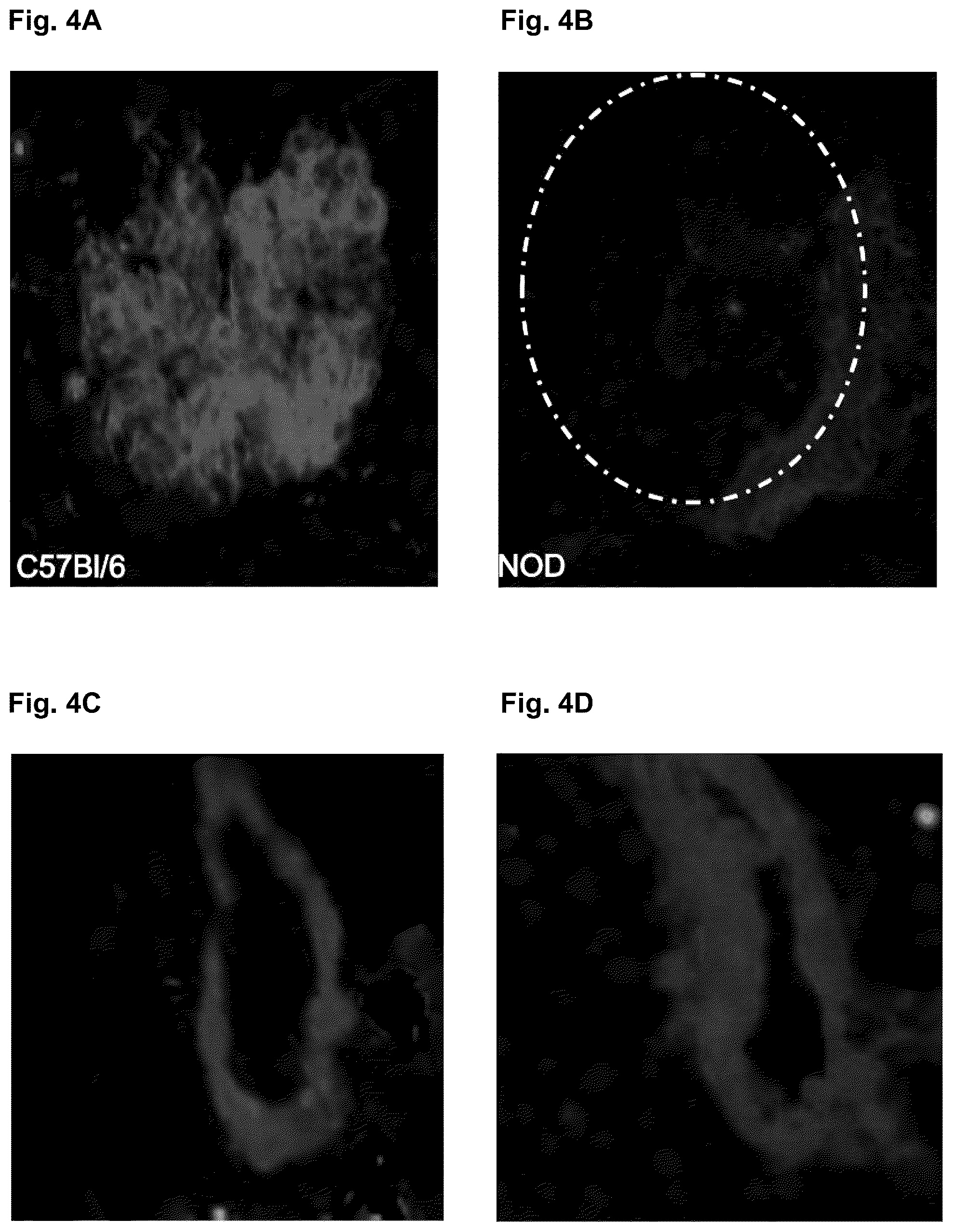Patent US12090173 Figure 4 – Methods to improve cell therapy