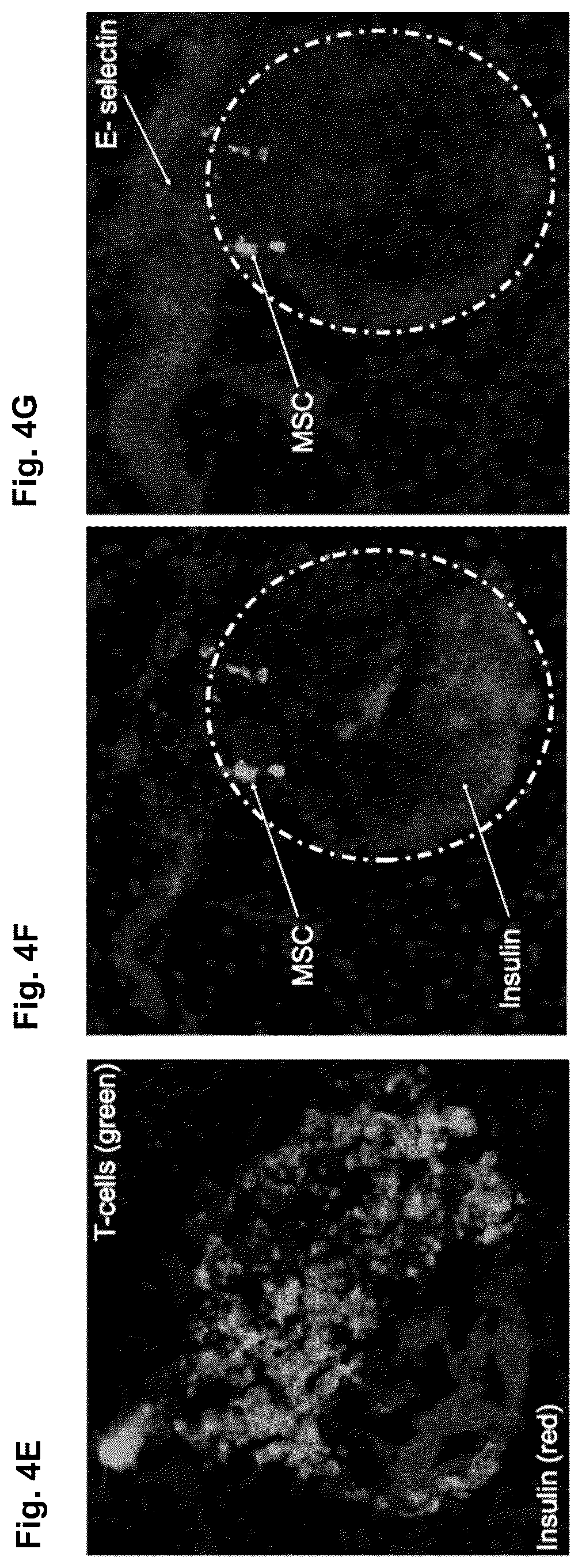 Patent US12090173 Figure 5 – Methods to improve cell therapy