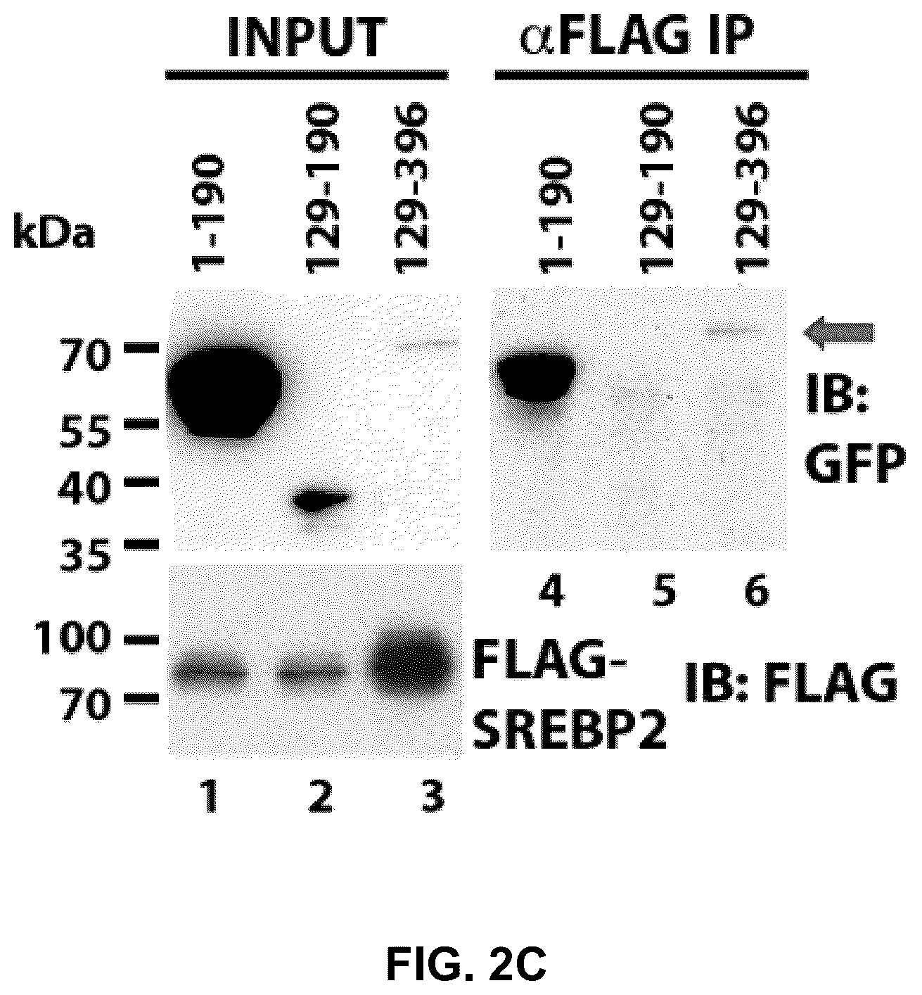 Patent US12090189 Figure 10 – Polypeptide inhibitor of de novo lipogenesis in cancer cells