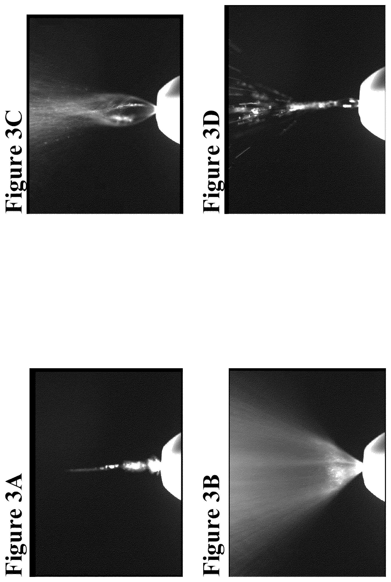 Patent US12090190 Figure 3 – Safe desmopressin administration