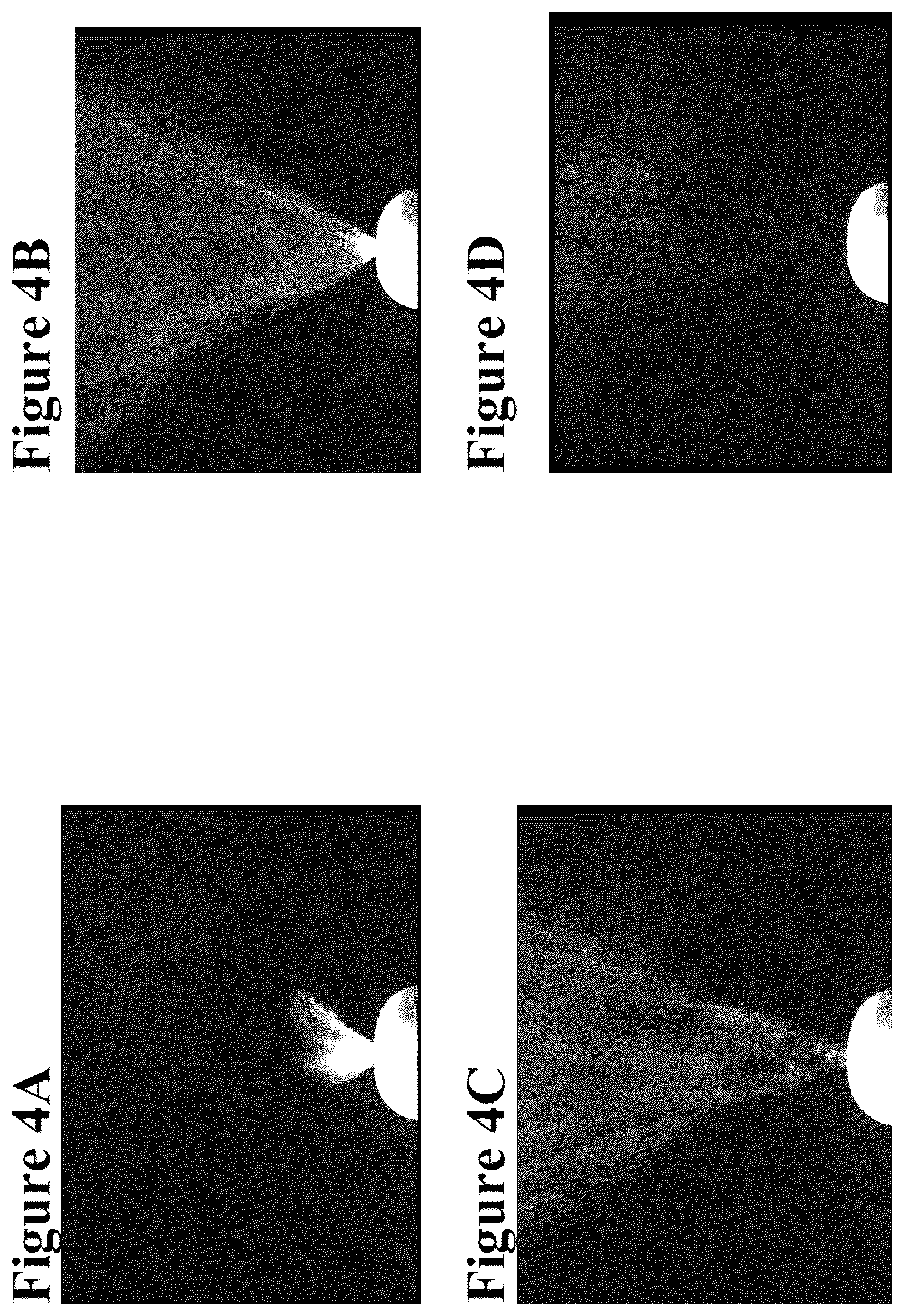 Patent US12090190 Figure 4 – Safe desmopressin administration