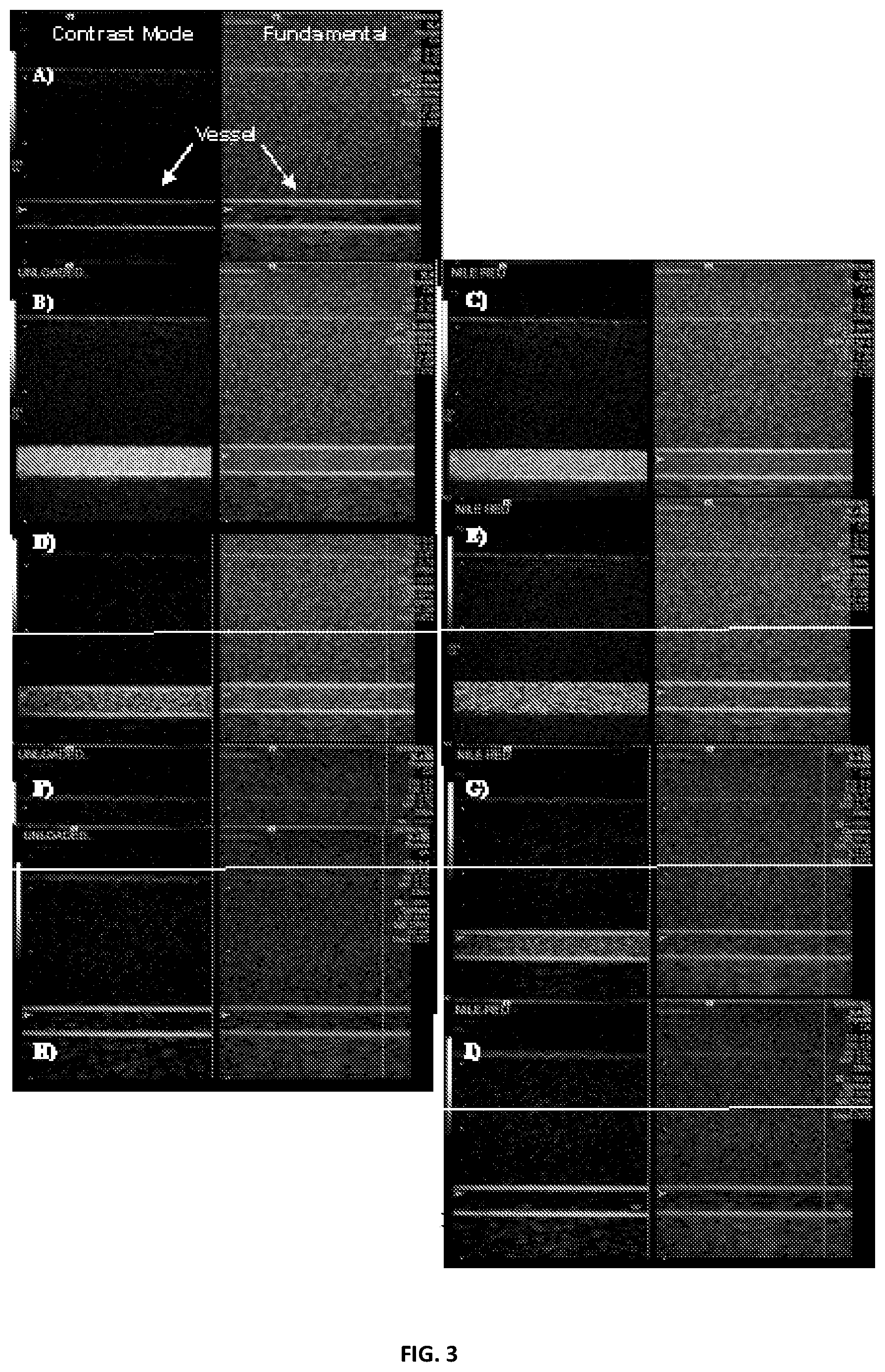 Patent US12090203 Figure 3 – Surfactant microbubbles compositions and process for preparing thereof