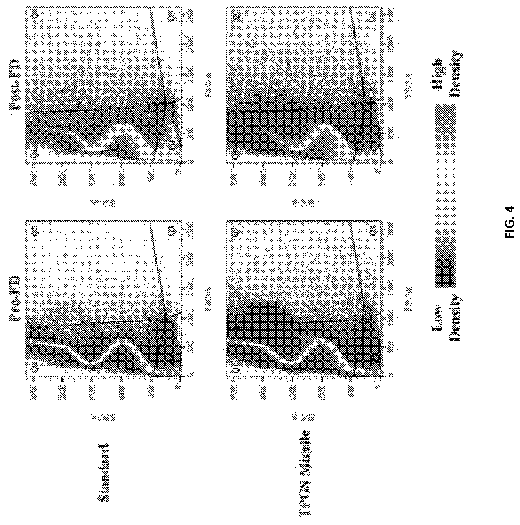 Patent US12090203 Figure 4 – Surfactant microbubbles compositions and process for preparing thereof