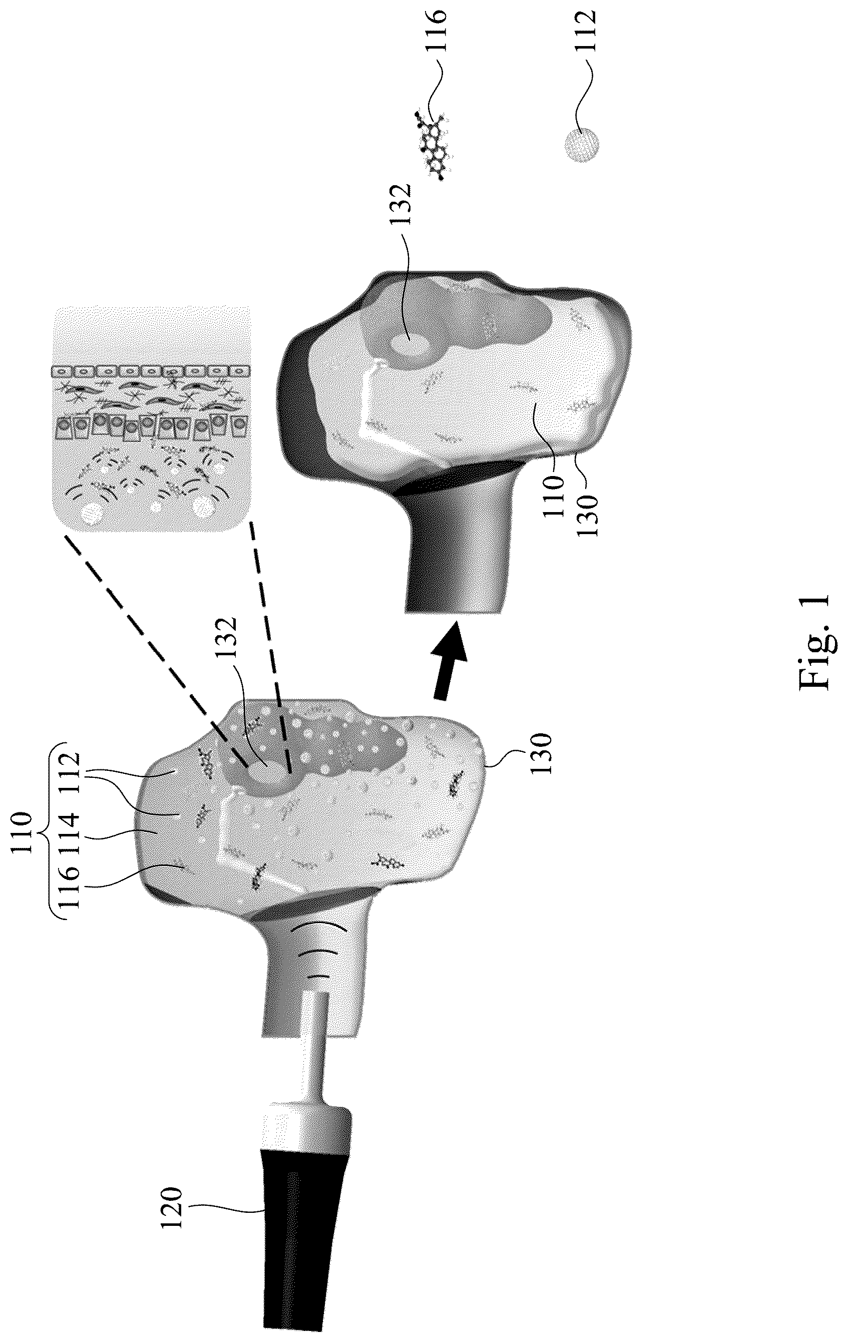 Patent US12090207 — Drug delivery composition, method forming the same and method for treating inner ear disorders — Figure 1