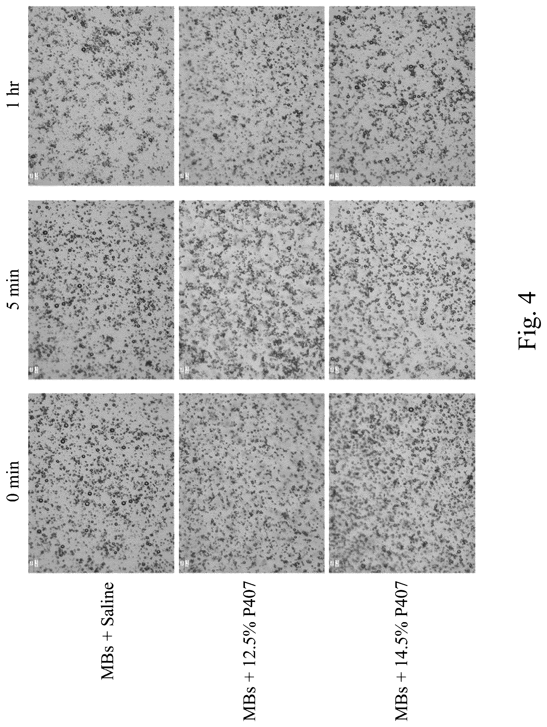Patent US12090207 Figure 4 – Drug delivery composition, method forming the same and method for treating inner ear disorders