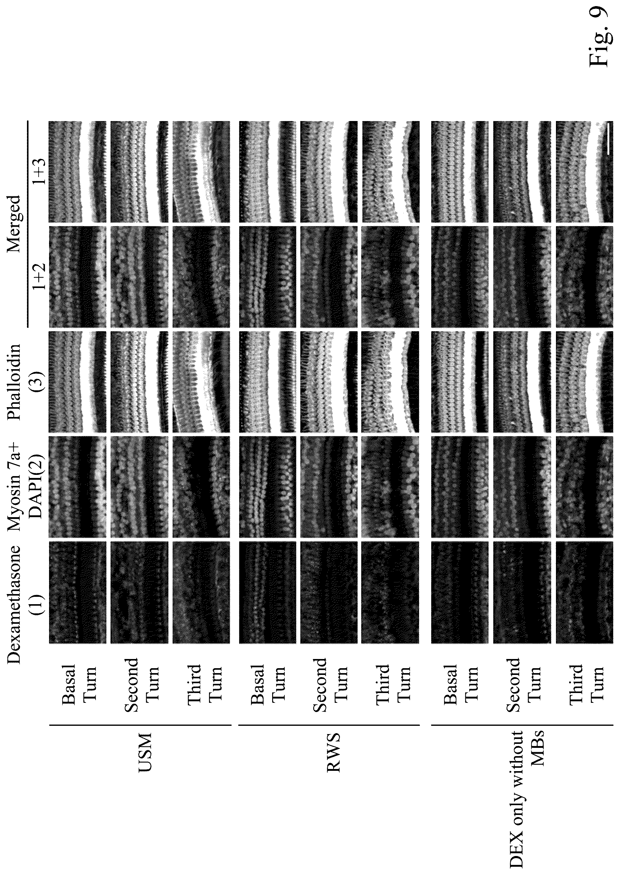 Patent US12090207 Figure 11 – Drug delivery composition, method forming the same and method for treating inner ear disorders