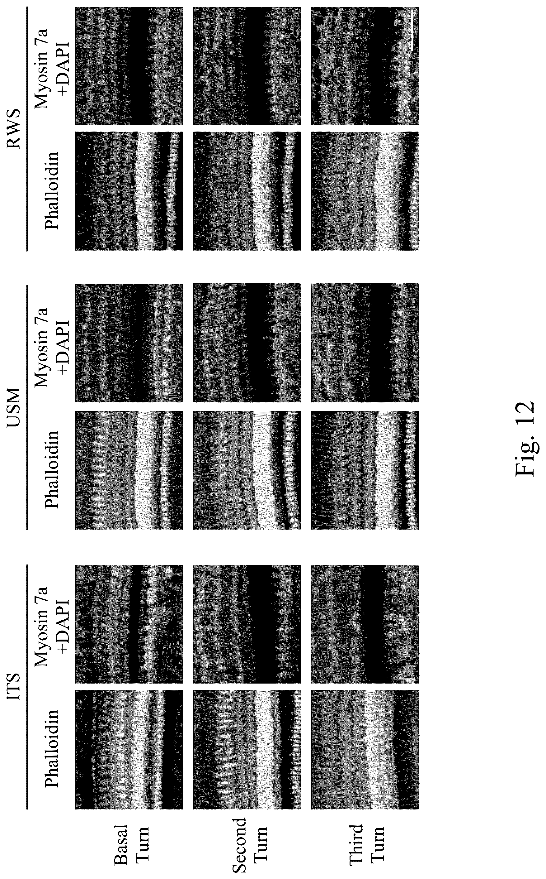 Patent US12090207 Figure 14 – Drug delivery composition, method forming the same and method for treating inner ear disorders