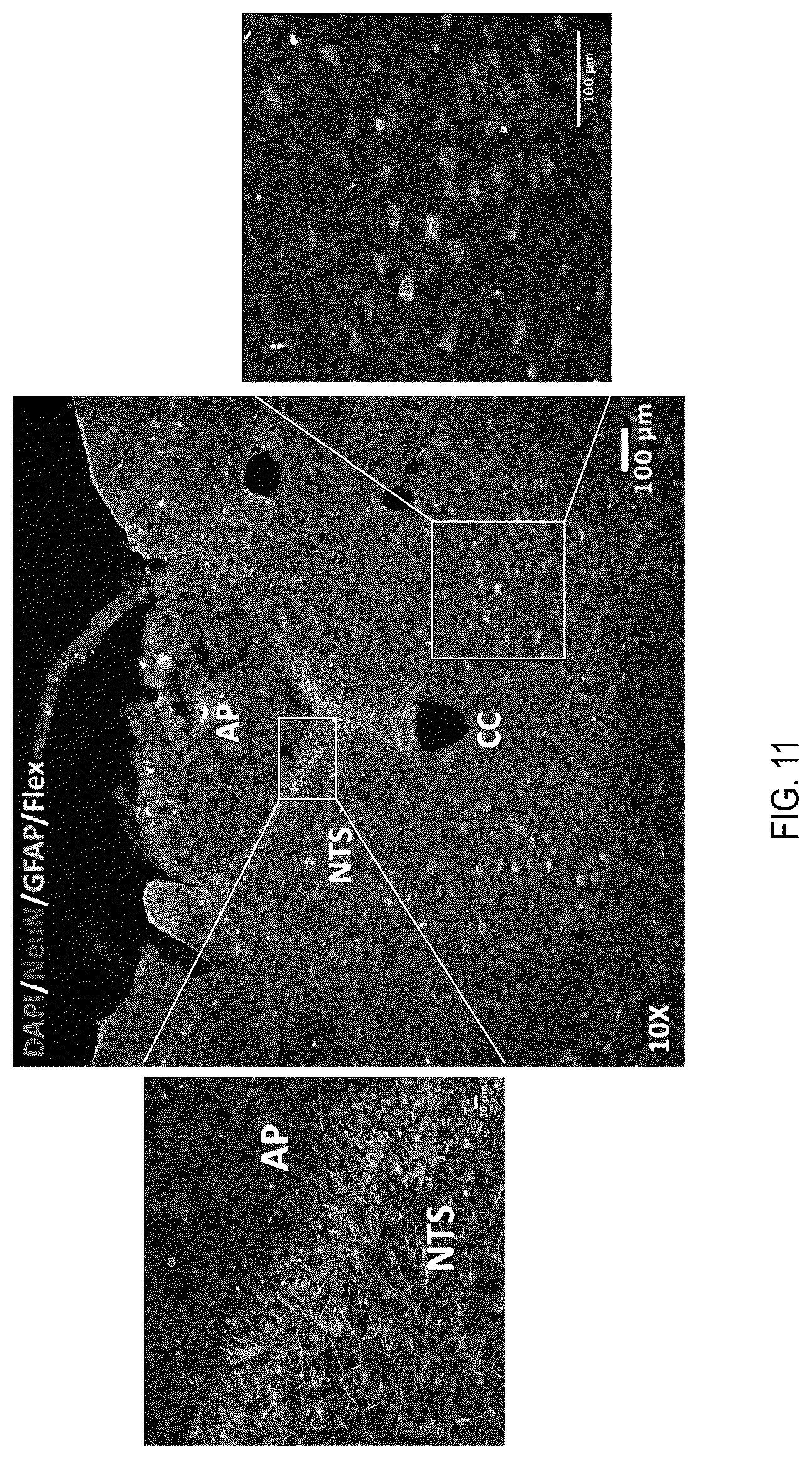 Patent US12090208 Figure 11 – Peptide drug improvement using vitamin B 12 and Haptocorrin binding substrate conjugates