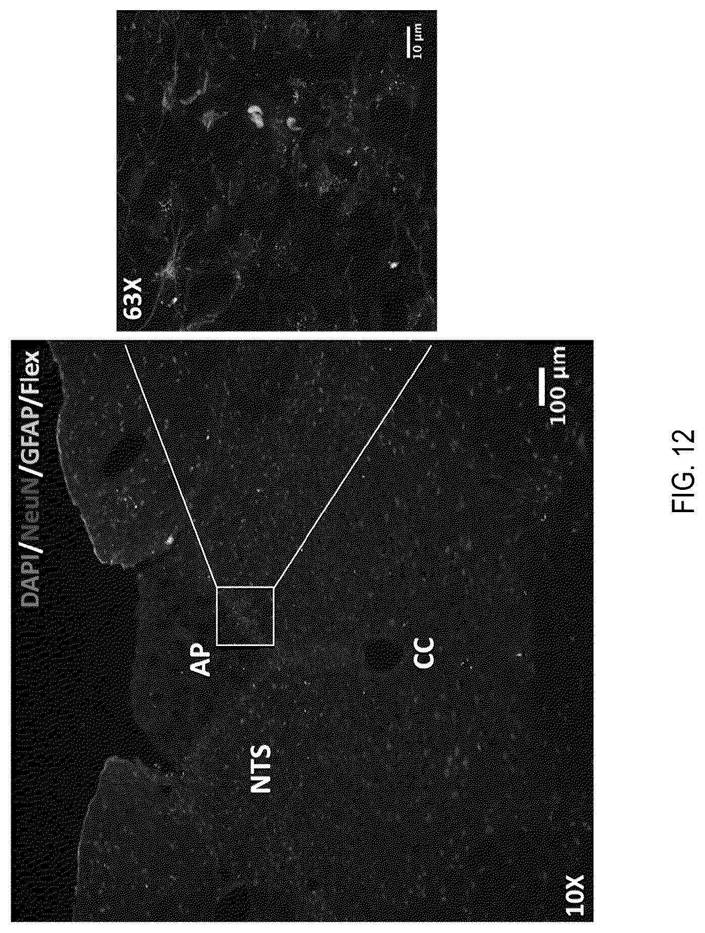 Patent US12090208 Figure 12 – Peptide drug improvement using vitamin B 12 and Haptocorrin binding substrate conjugates
