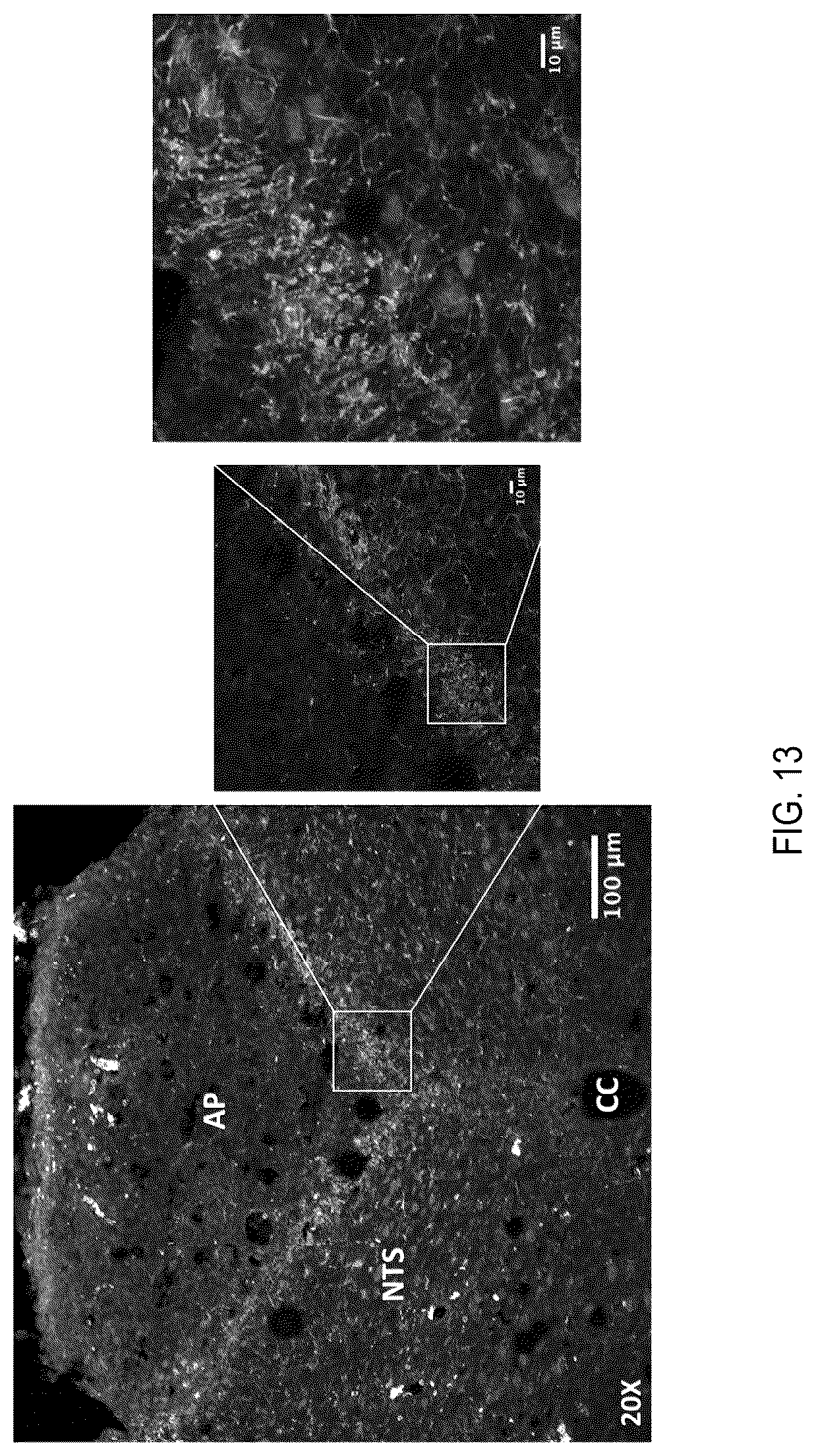 Patent US12090208 Figure 13 – Peptide drug improvement using vitamin B 12 and Haptocorrin binding substrate conjugates