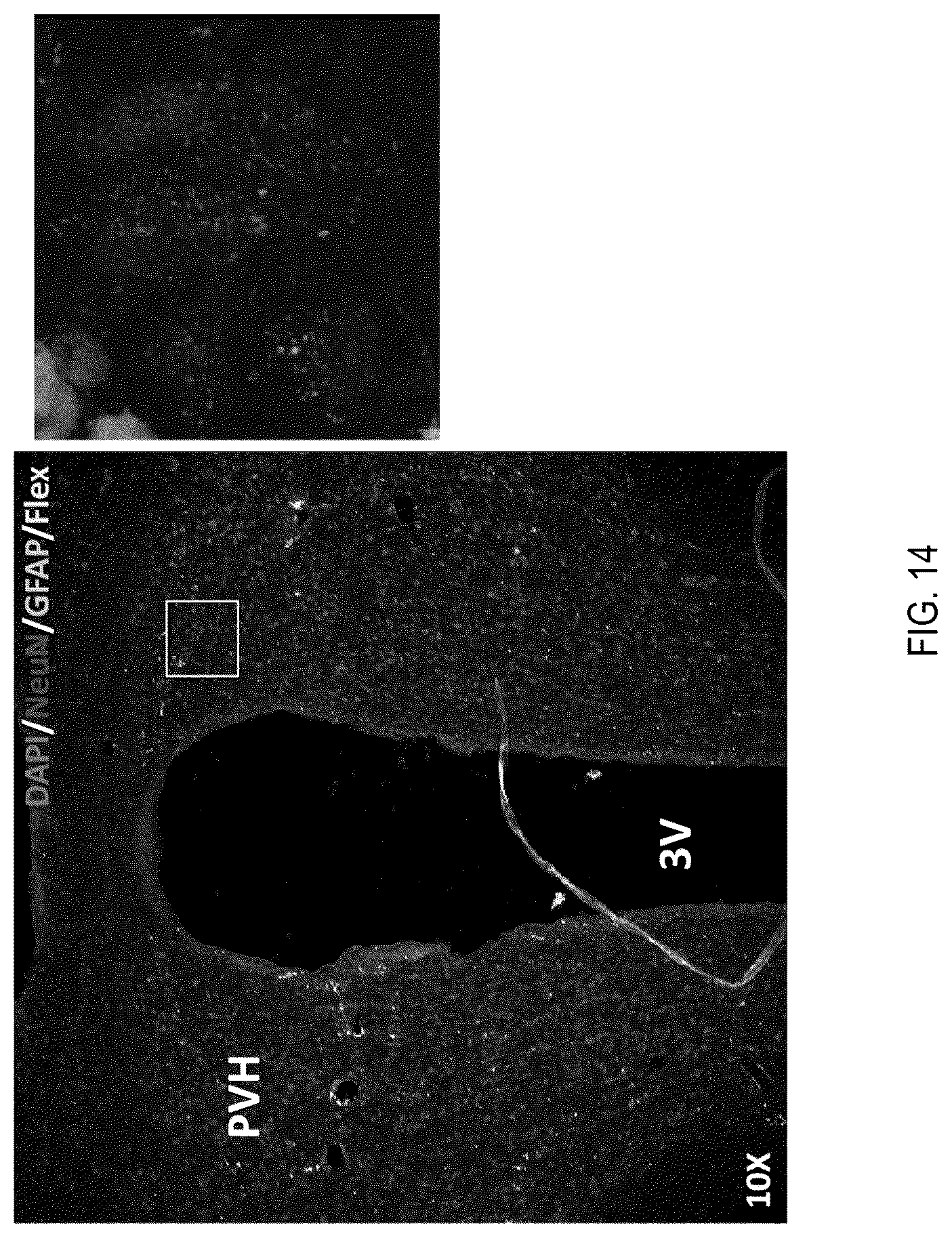 Patent US12090208 Figure 14 – Peptide drug improvement using vitamin B 12 and Haptocorrin binding substrate conjugates