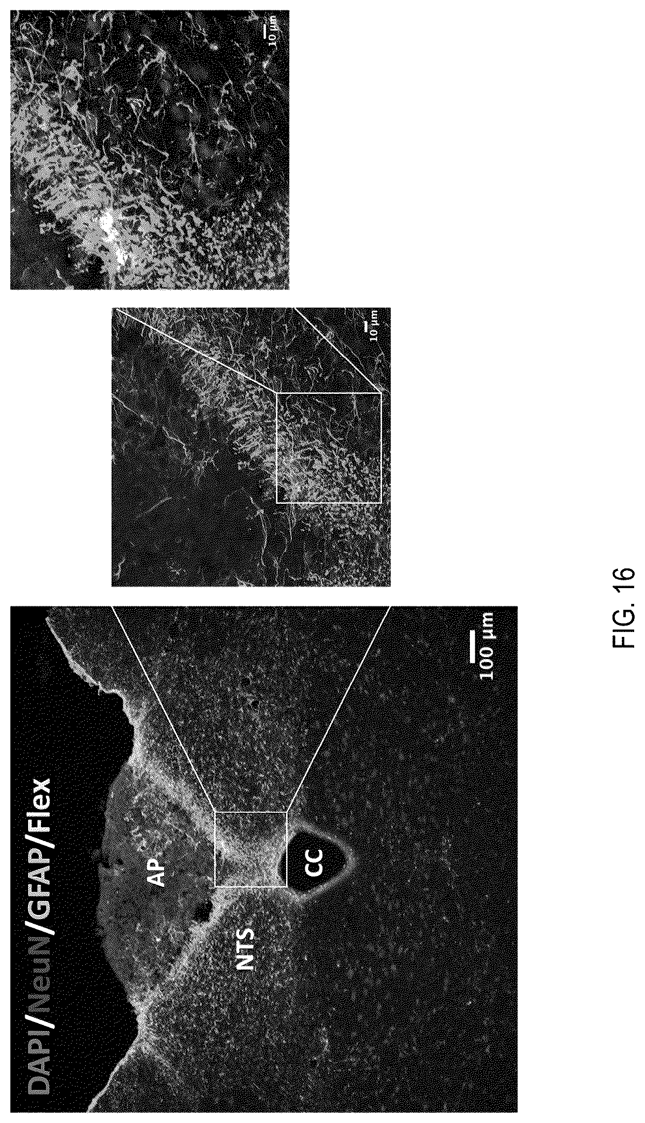 Patent US12090208 Figure 16 – Peptide drug improvement using vitamin B 12 and Haptocorrin binding substrate conjugates