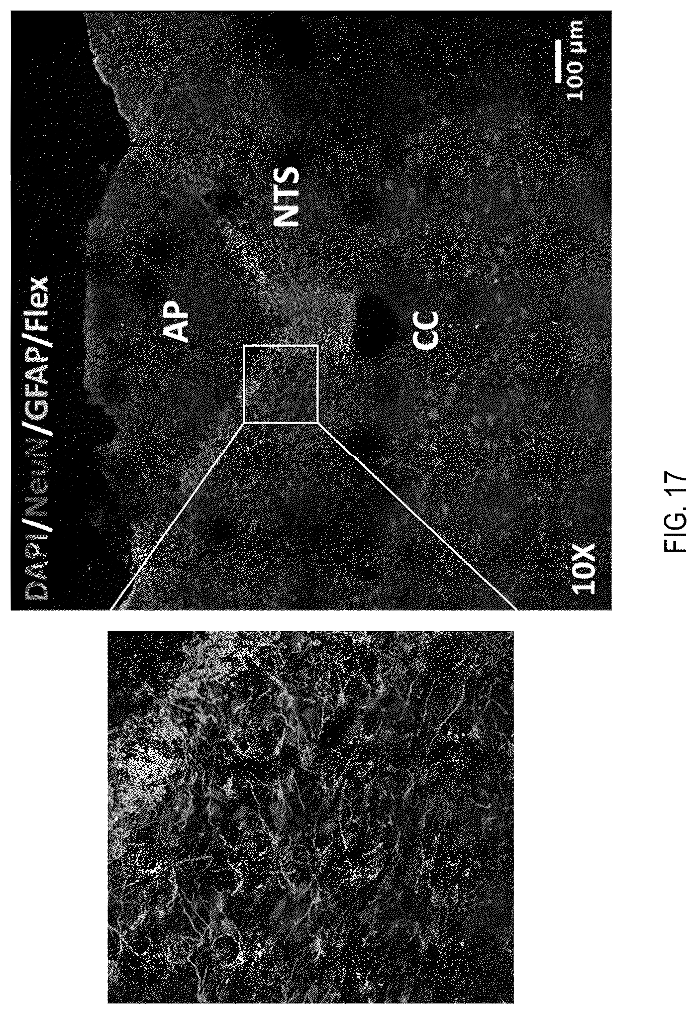 Patent US12090208 Figure 17 – Peptide drug improvement using vitamin B 12 and Haptocorrin binding substrate conjugates