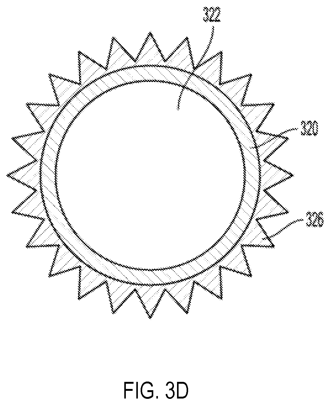 Patent US12090215 Figure 9 – Method and device for direct production of radio-isotope based cancer treatment pharmaceuticals