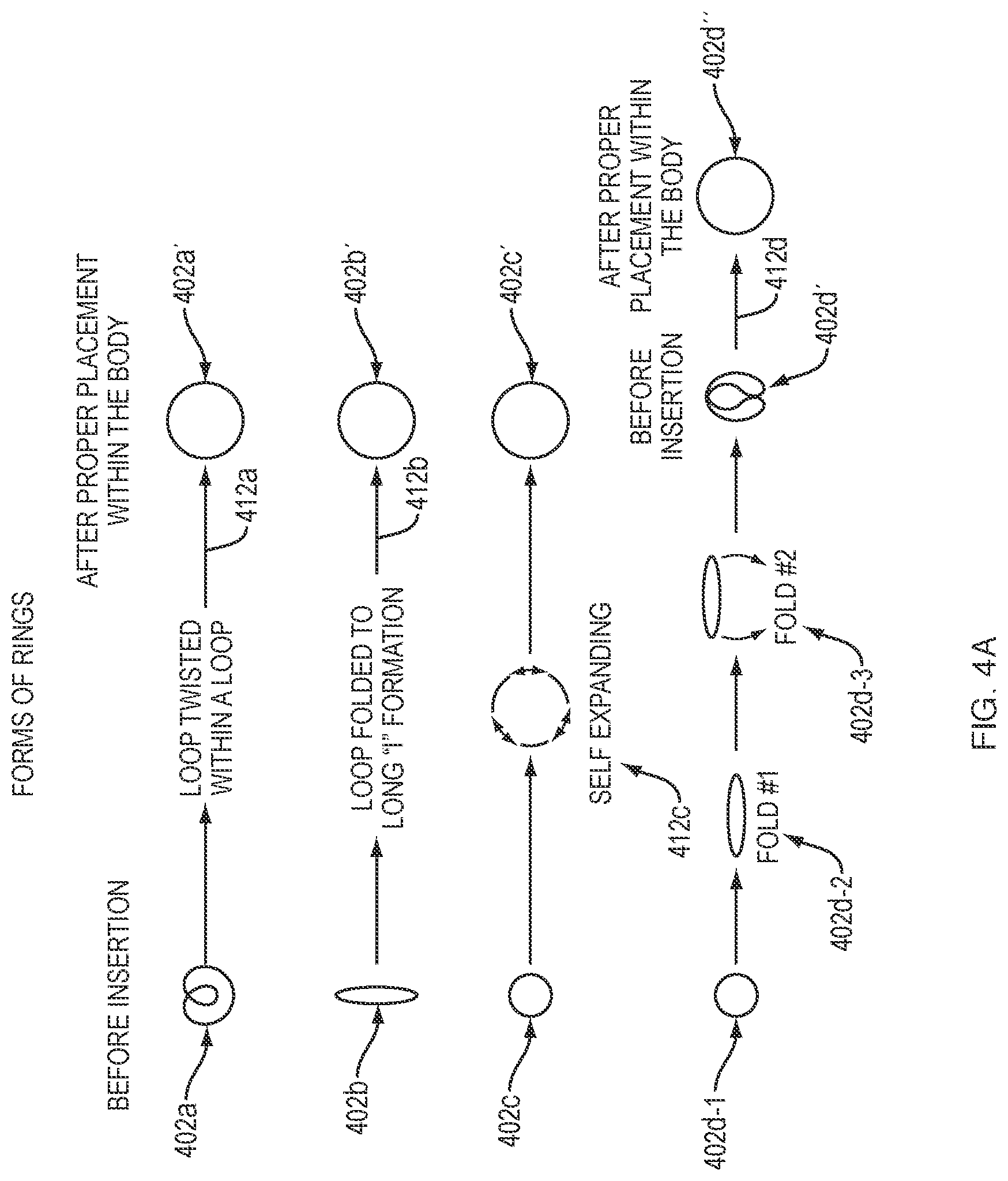 Patent US12090226 Figure 4 – Hydrocortisone acetate suppository formulation for treatment of disease