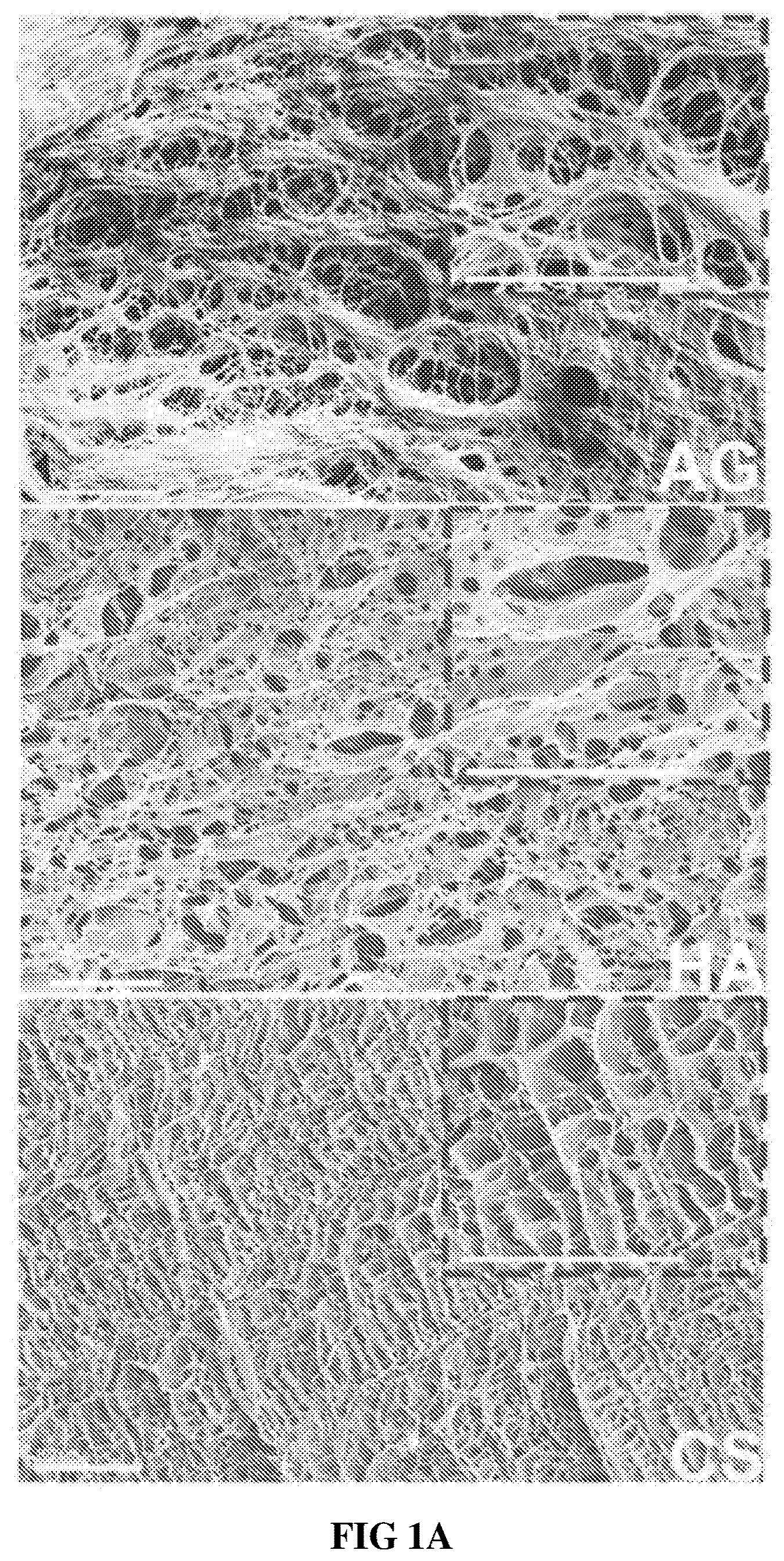 Patent US12090229 Figure 1 – Chondroitin sulfate glycosaminoglycan hydrogel matrices for the treatment of traumatic brain injury