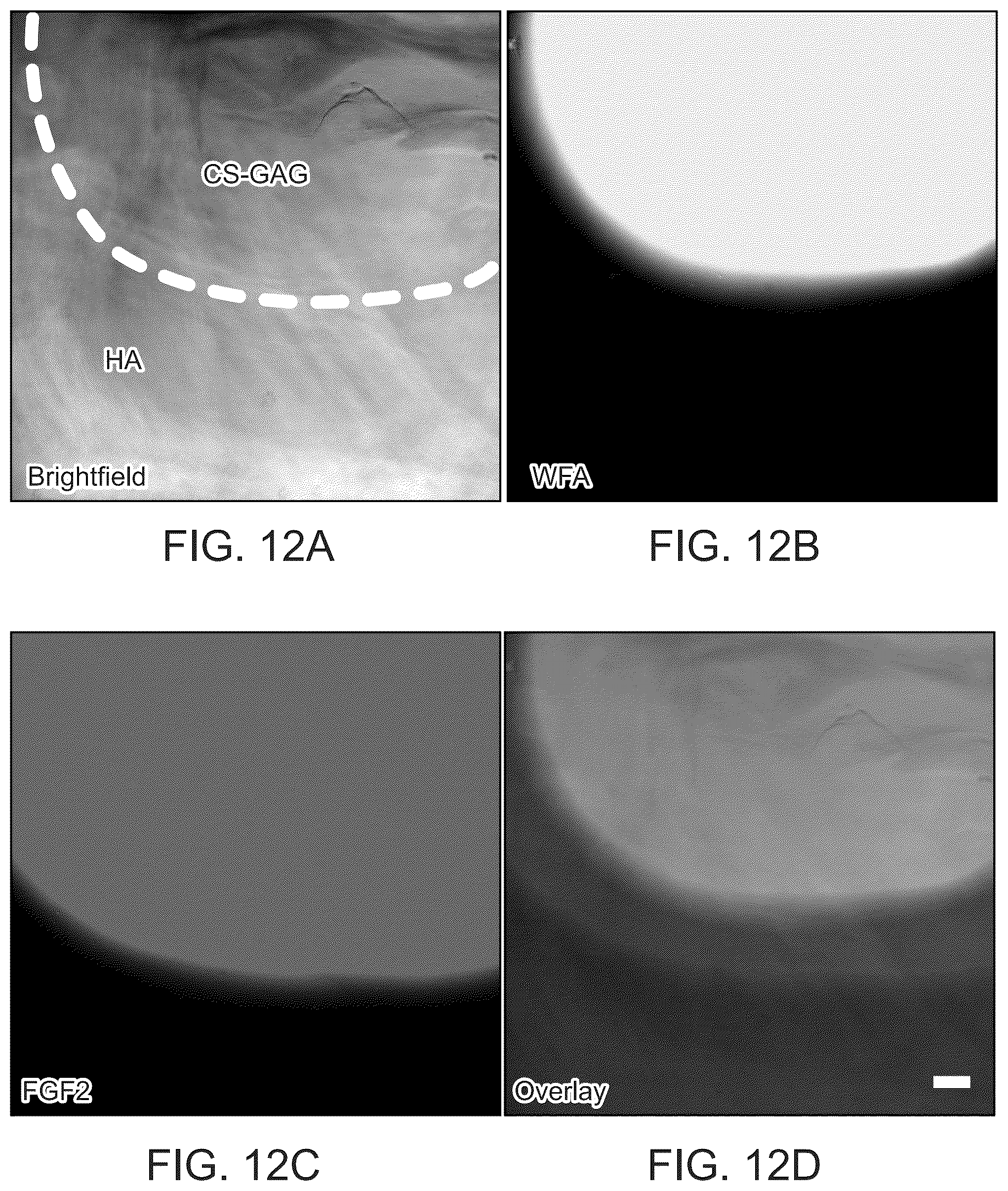 Patent US12090229 Figure 18 – Chondroitin sulfate glycosaminoglycan hydrogel matrices for the treatment of traumatic brain injury