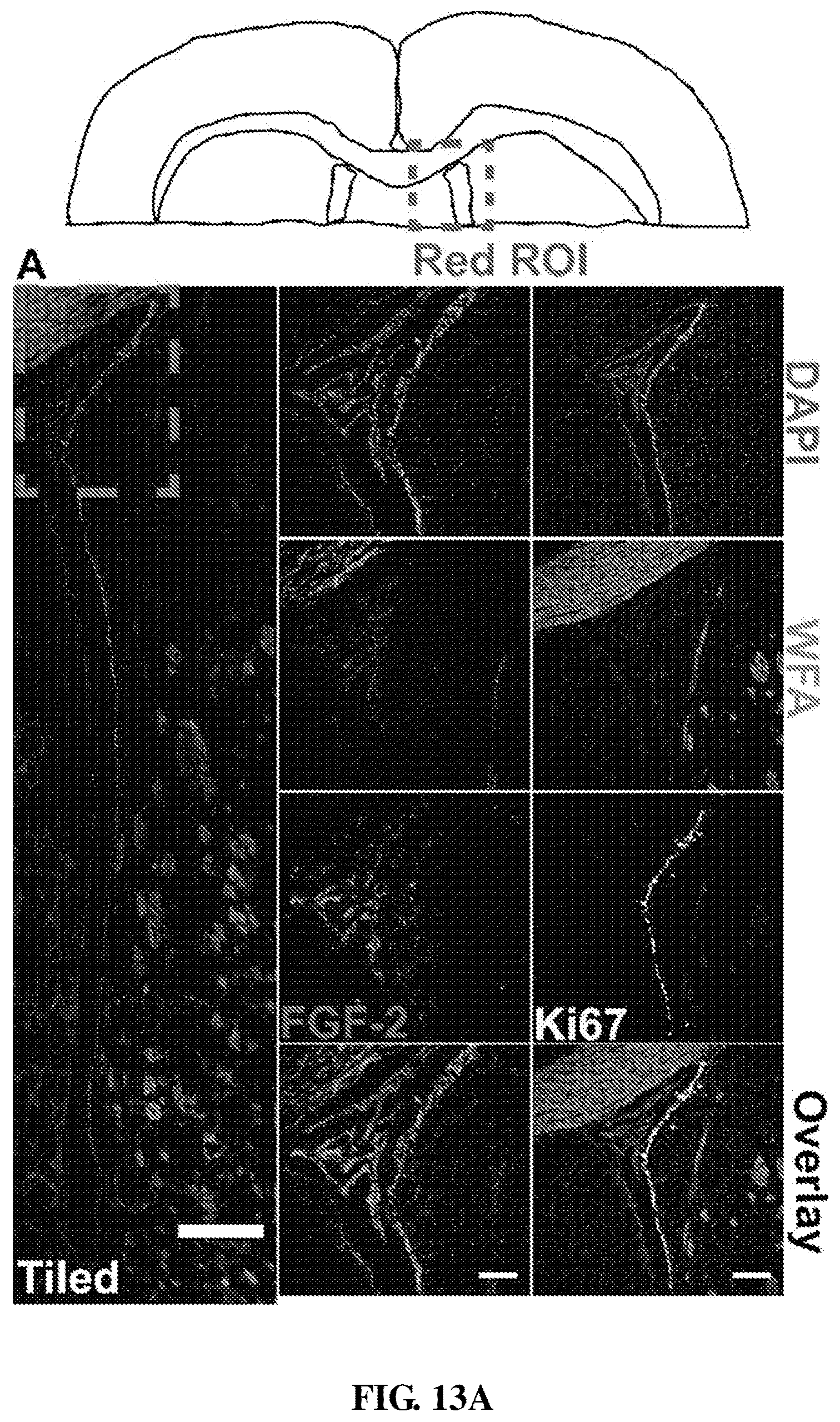 Patent US12090229 Figure 19 – Chondroitin sulfate glycosaminoglycan hydrogel matrices for the treatment of traumatic brain injury