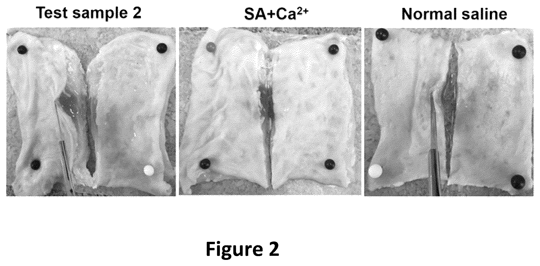 Patent US12090243 Figure 2 – Compositions comprising fluid gels for tissue separation