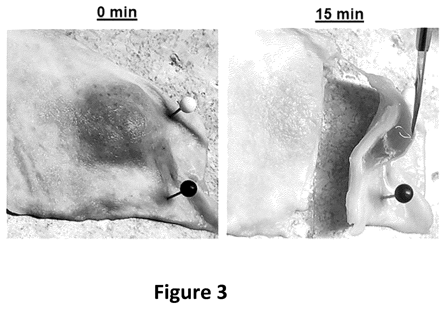 Patent US12090243 Figure 3 – Compositions comprising fluid gels for tissue separation