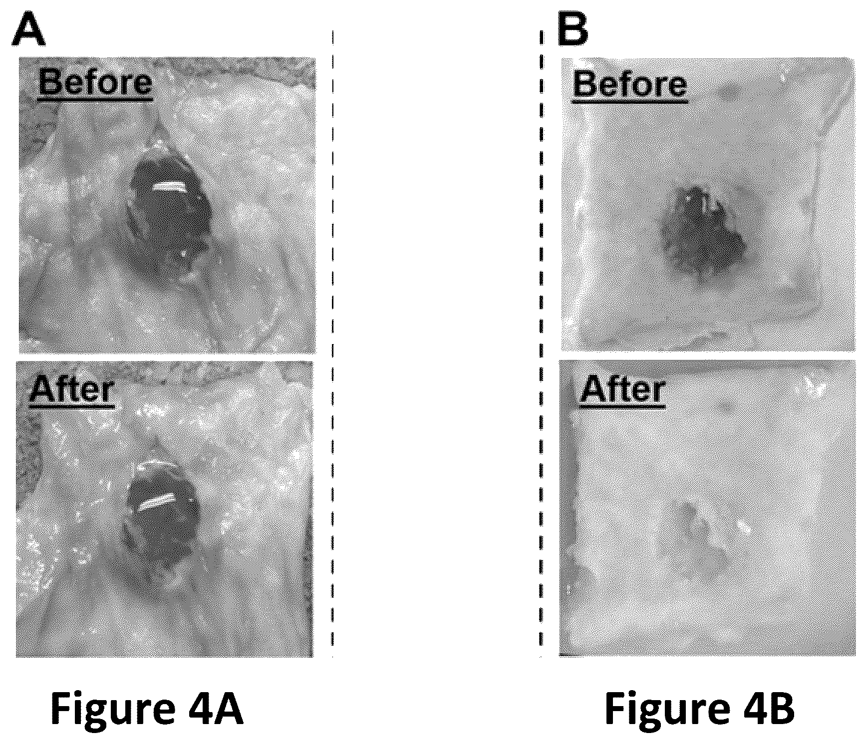 Patent US12090243 Figure 4 – Compositions comprising fluid gels for tissue separation