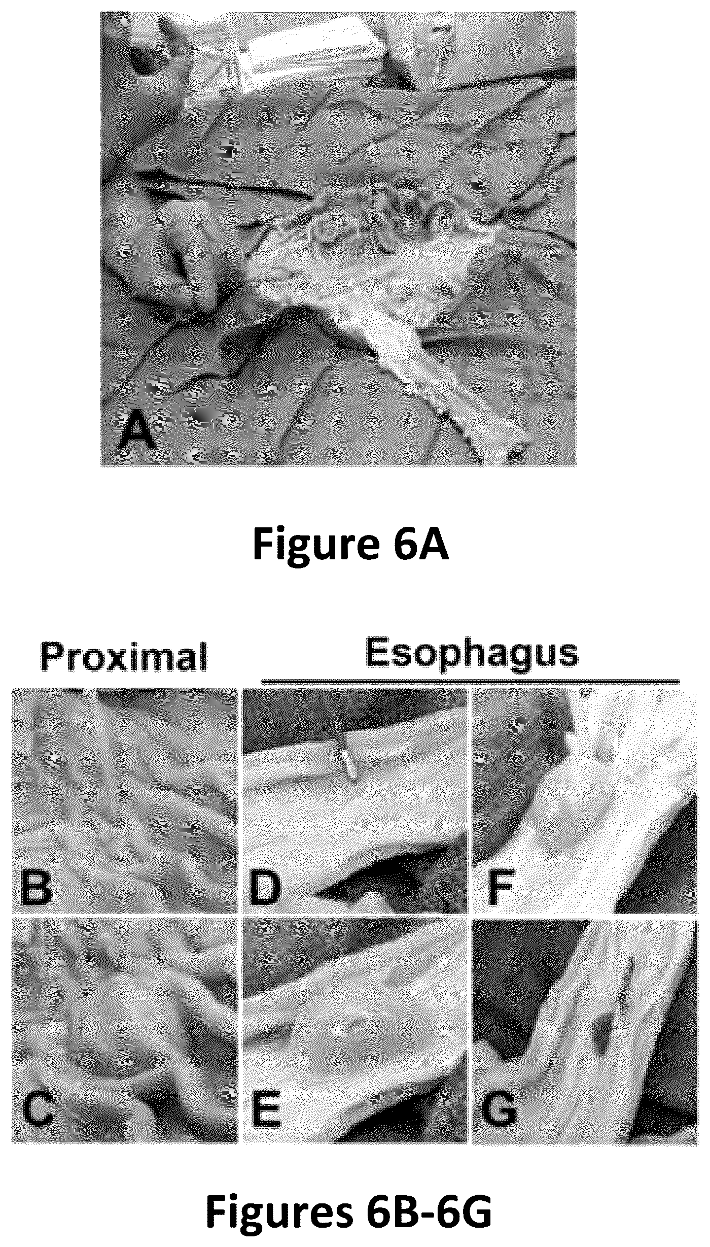 Patent US12090243 Figure 6 – Compositions comprising fluid gels for tissue separation