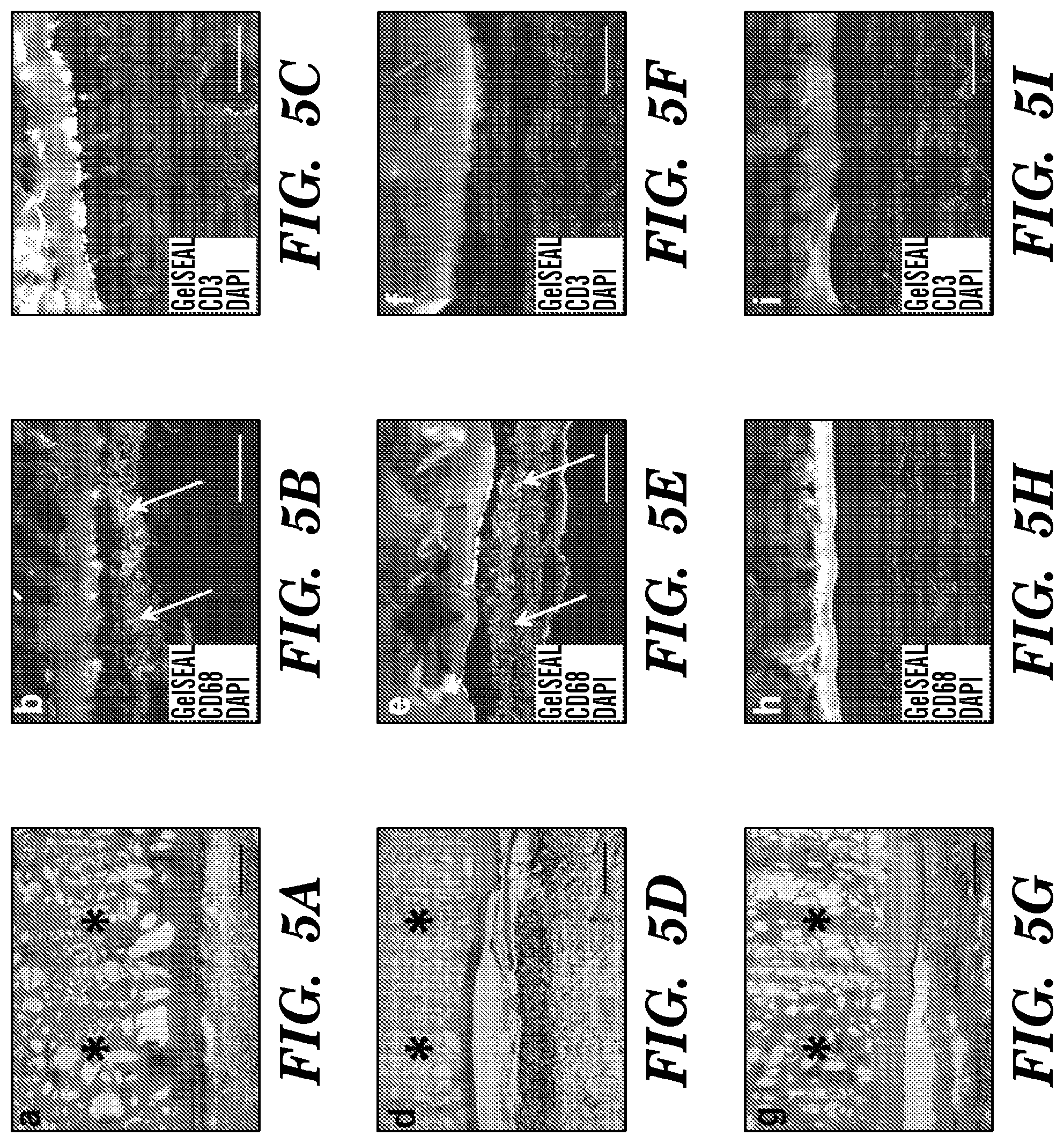 Patent US12090246 Figure 7 – Elastic biopolymer and use as a tissue adhesive
