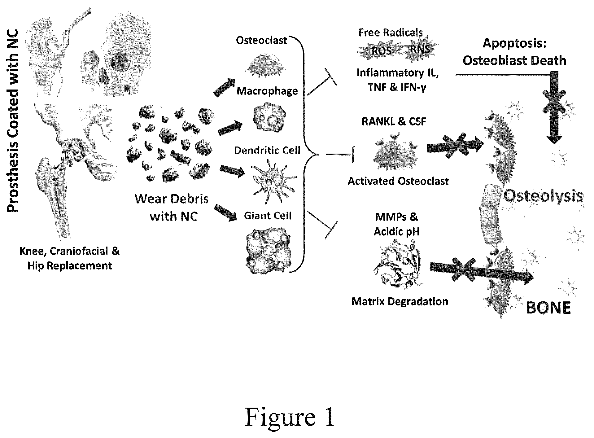 Patent US12090249 Figure 1 – Implant and coating to reduce osteolysis