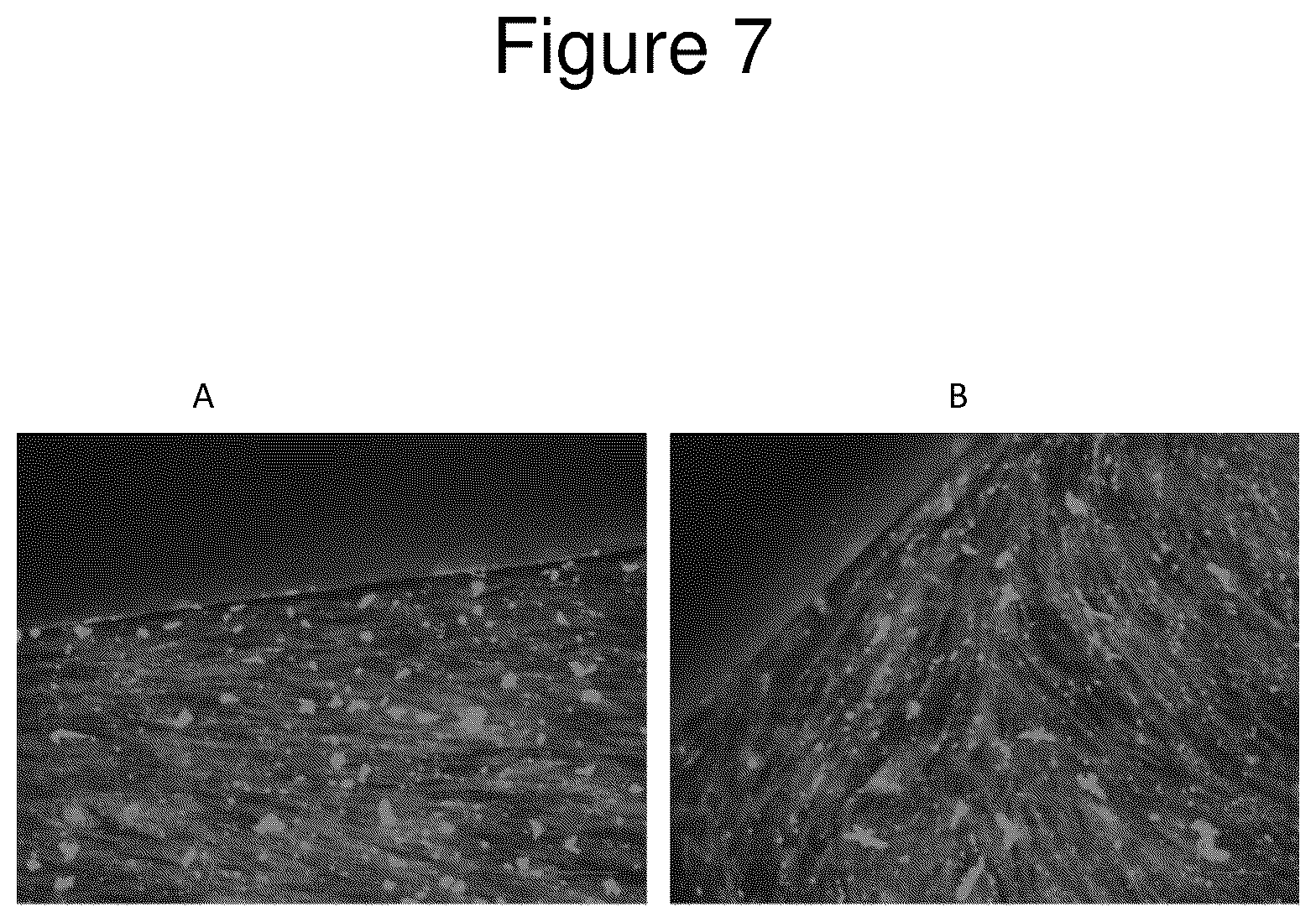 Patent US12090249 Figure 7 – Implant and coating to reduce osteolysis