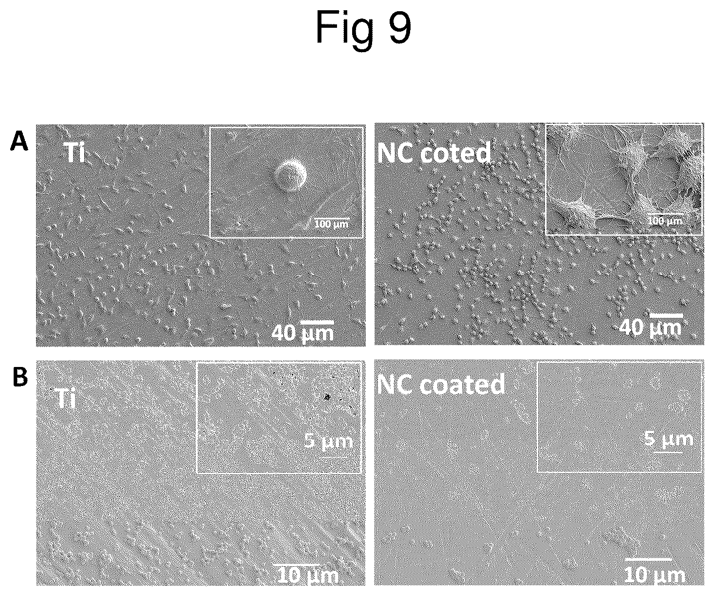 Patent US12090249 Figure 9 – Implant and coating to reduce osteolysis