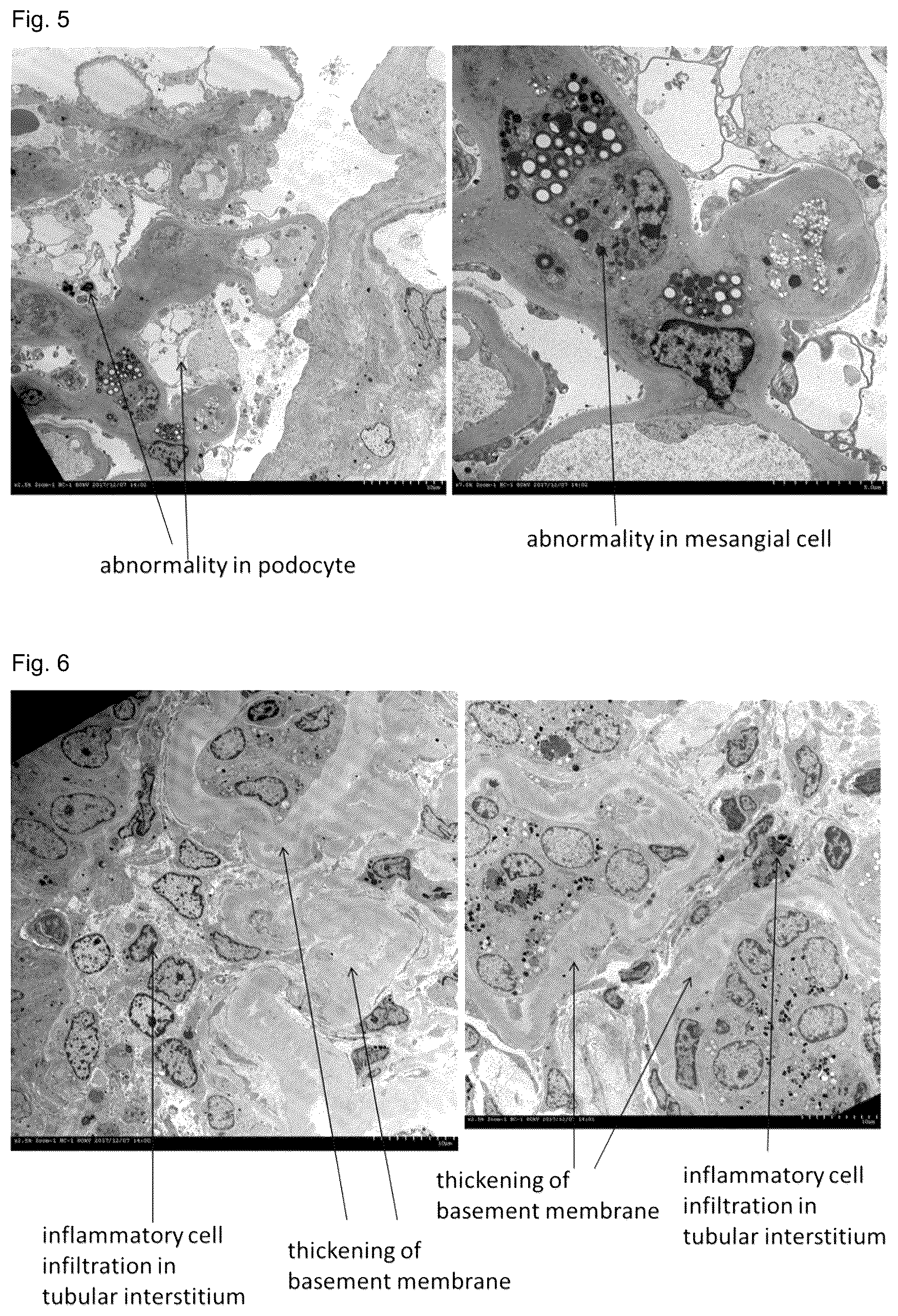 Patent US12090251 Figure 3 – Cell sheet for transplantation into living body and method for producing same