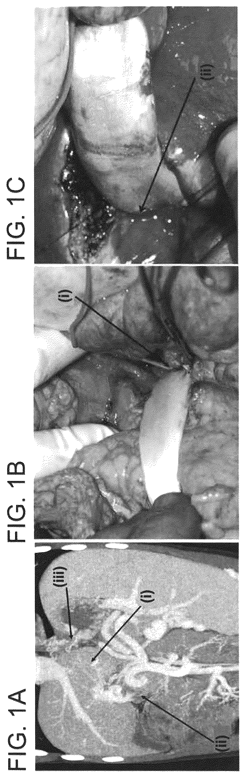 Patent US12090253 Figure 1 – Bioengineered allogeneic blood vessel