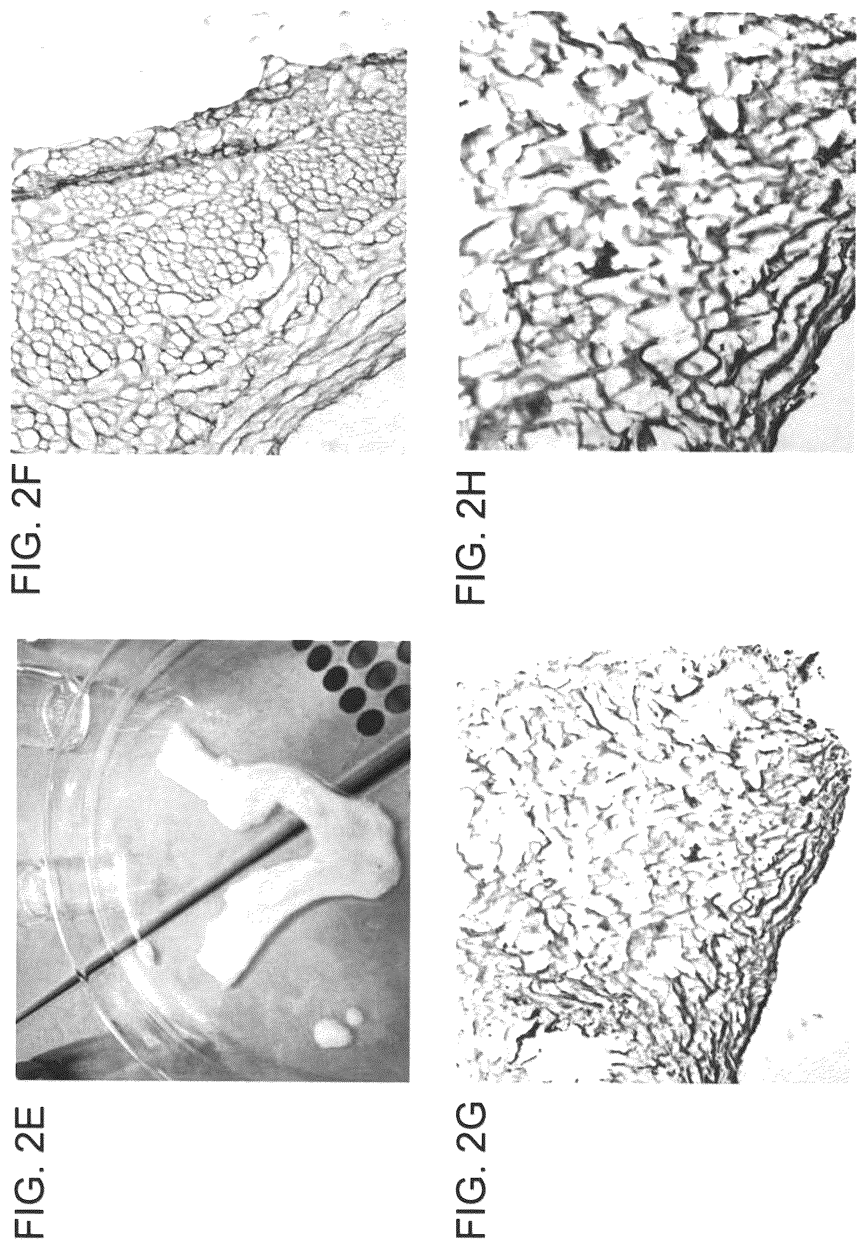 Patent US12090253 Figure 4 – Bioengineered allogeneic blood vessel