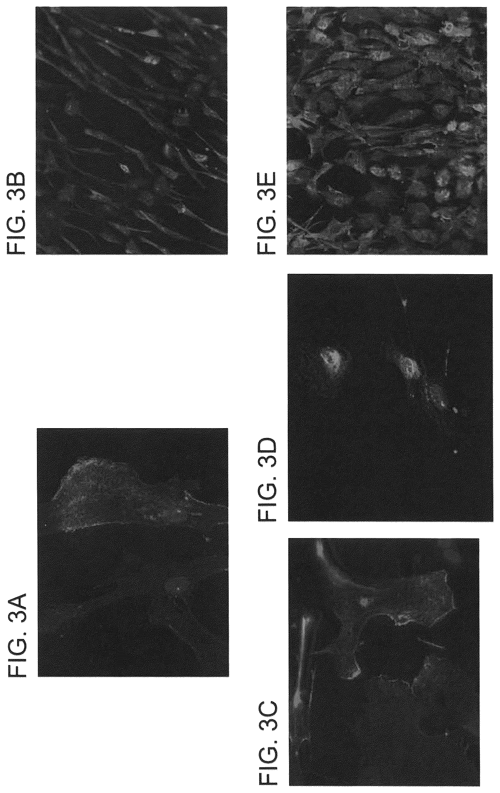 Patent US12090253 Figure 6 – Bioengineered allogeneic blood vessel
